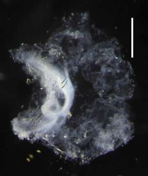 Image of Lilyopsis fluoracantha Haddock, Dunn & Pugh 2005