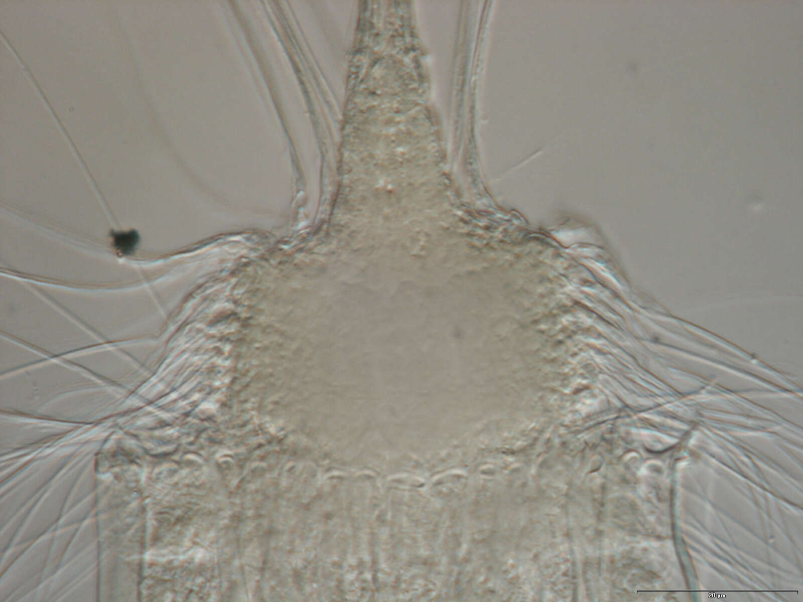 Image of Nanaloricidae