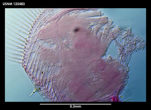 Image de Archasterope pentathrix (Kornicker 1971)