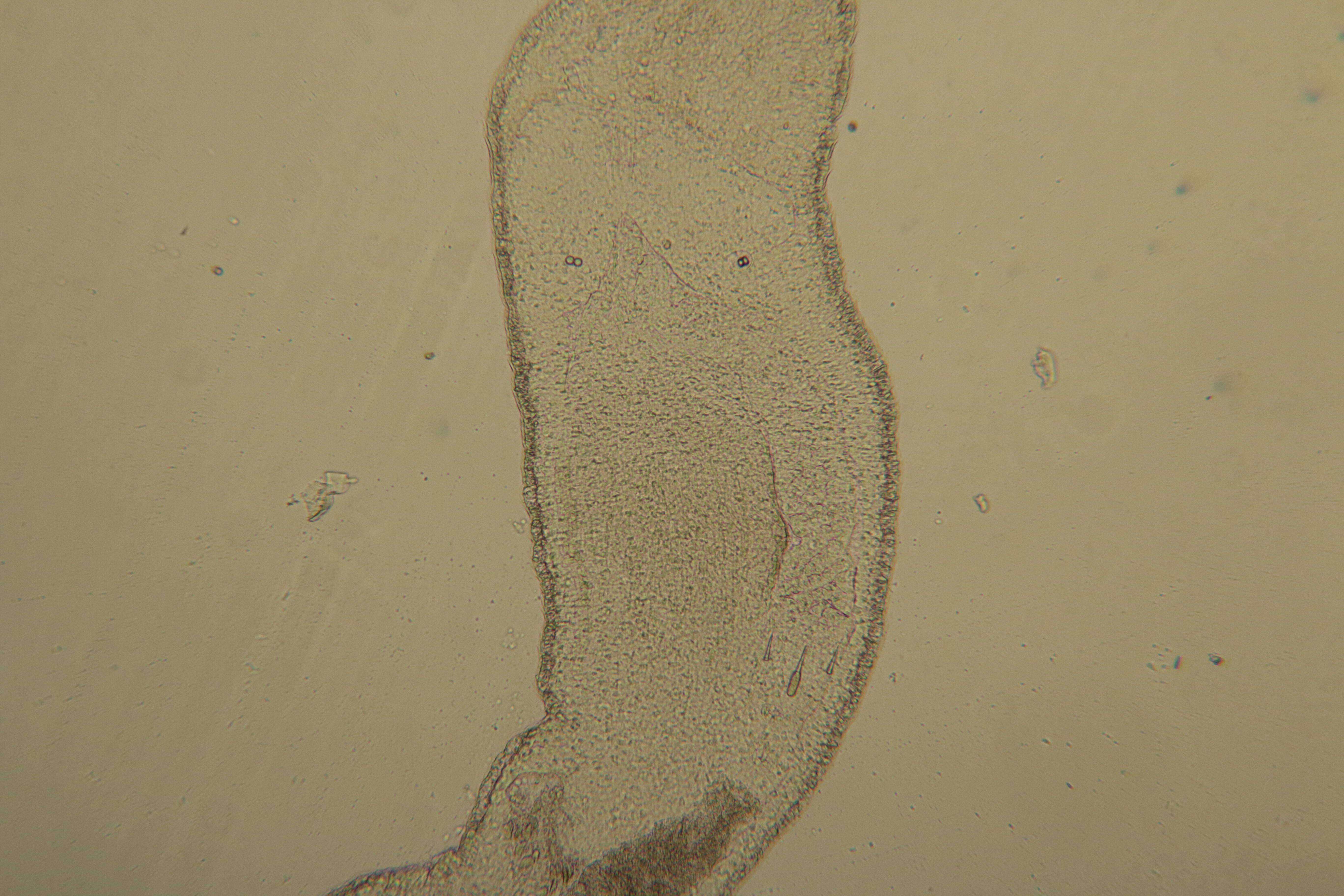 Image of Ototyphlonemertes (Duplex) duplex Bürger 1895