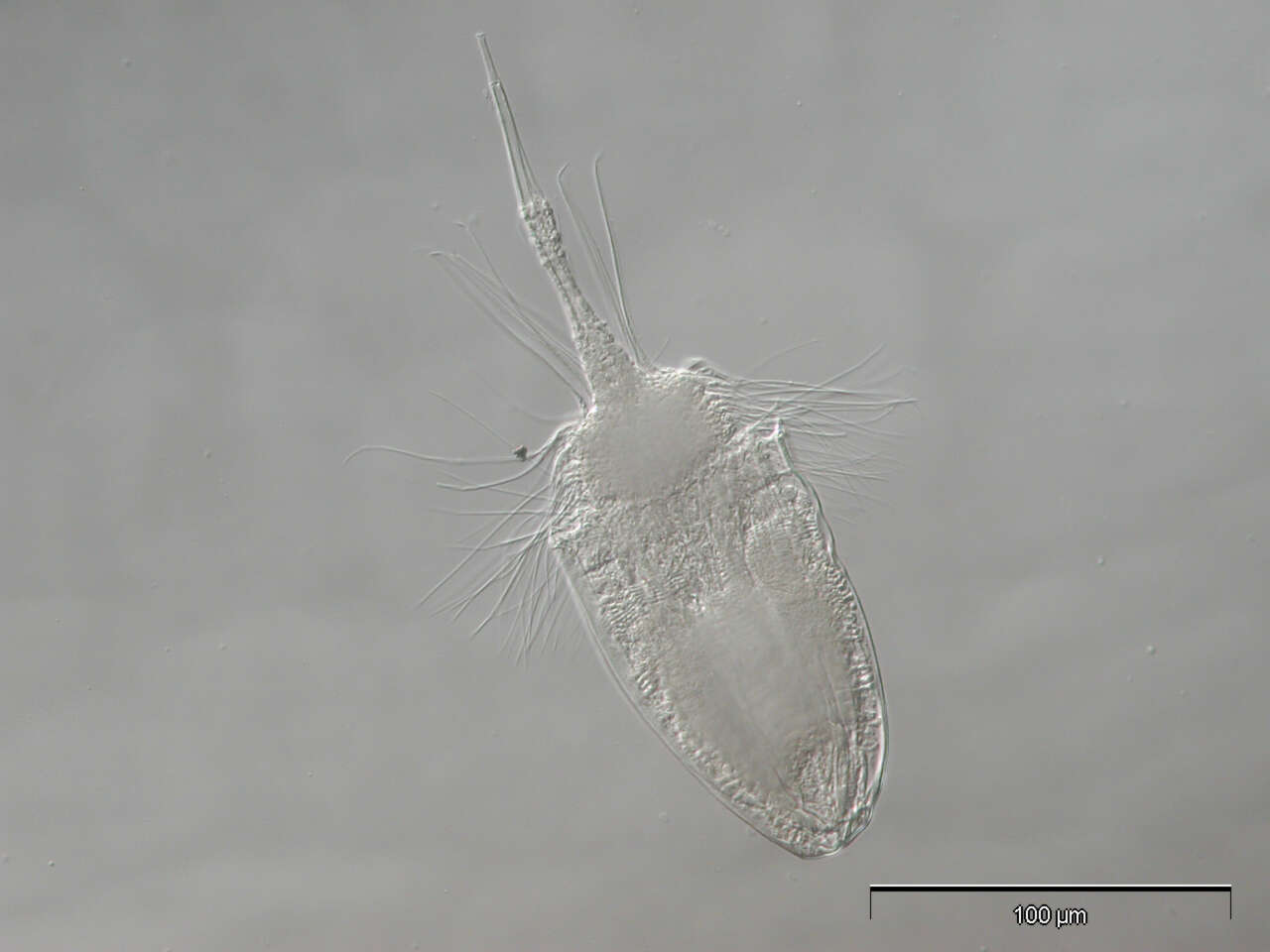 Image of Nanaloricidae