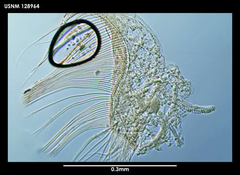 Image de Archasterope bulla Kornicker 1975