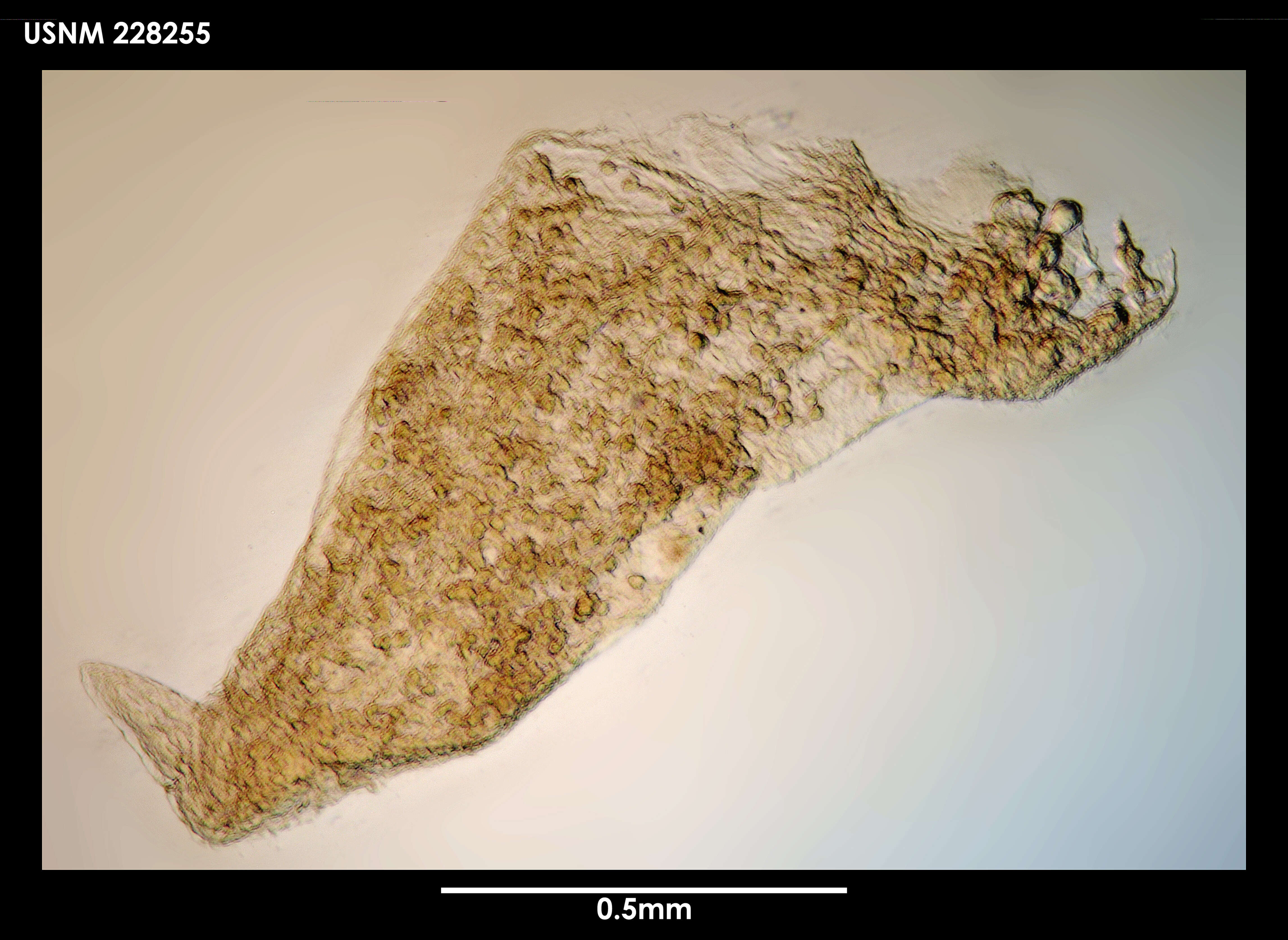 Image de Gongylophysema asetosum Grygier 1987