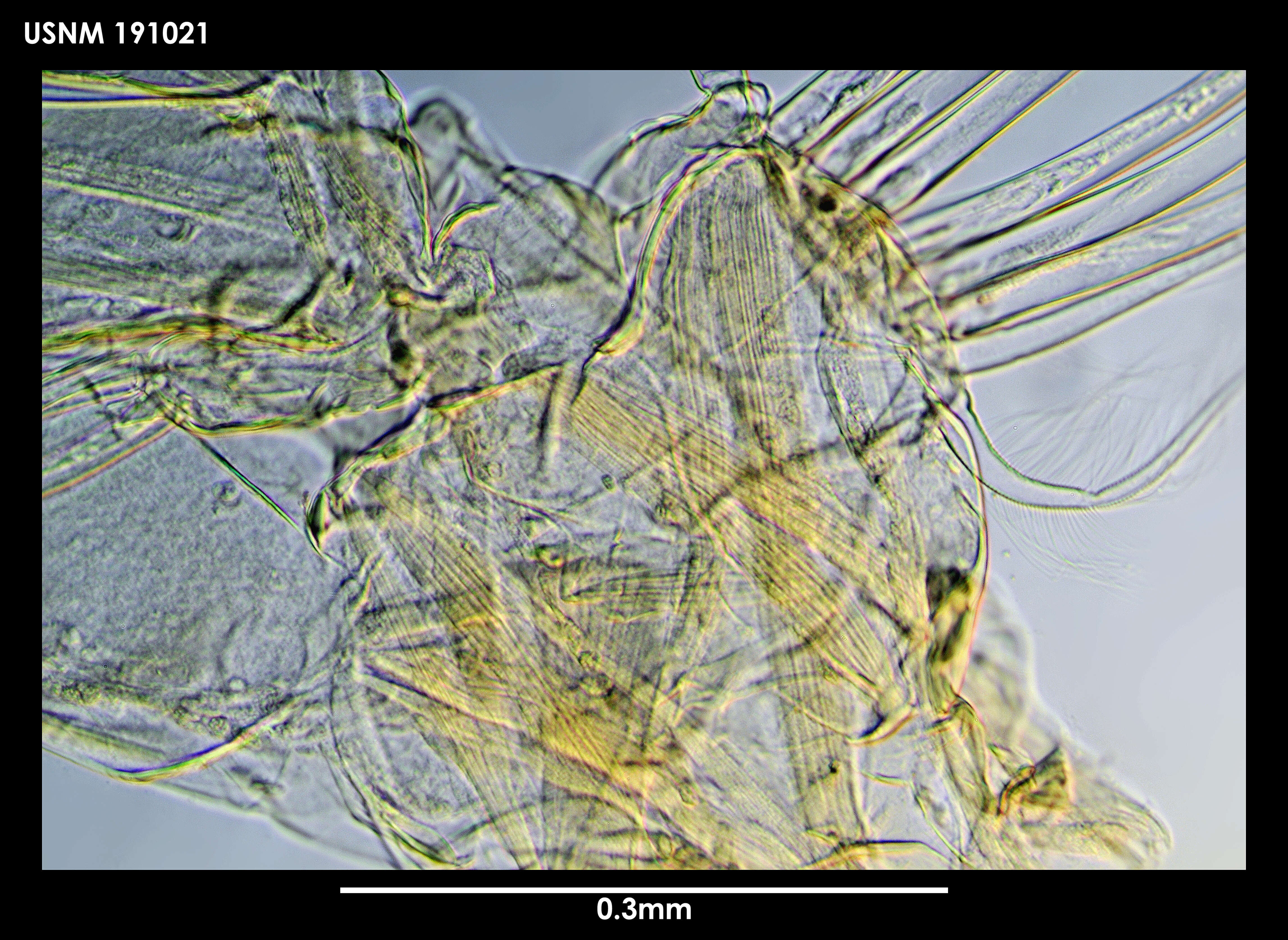 Слика од Xanthocalanus harpagatus Bradford & Wells 1983