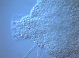 Image of Pliciloricus orphanus Higgins & Kristensen 1986