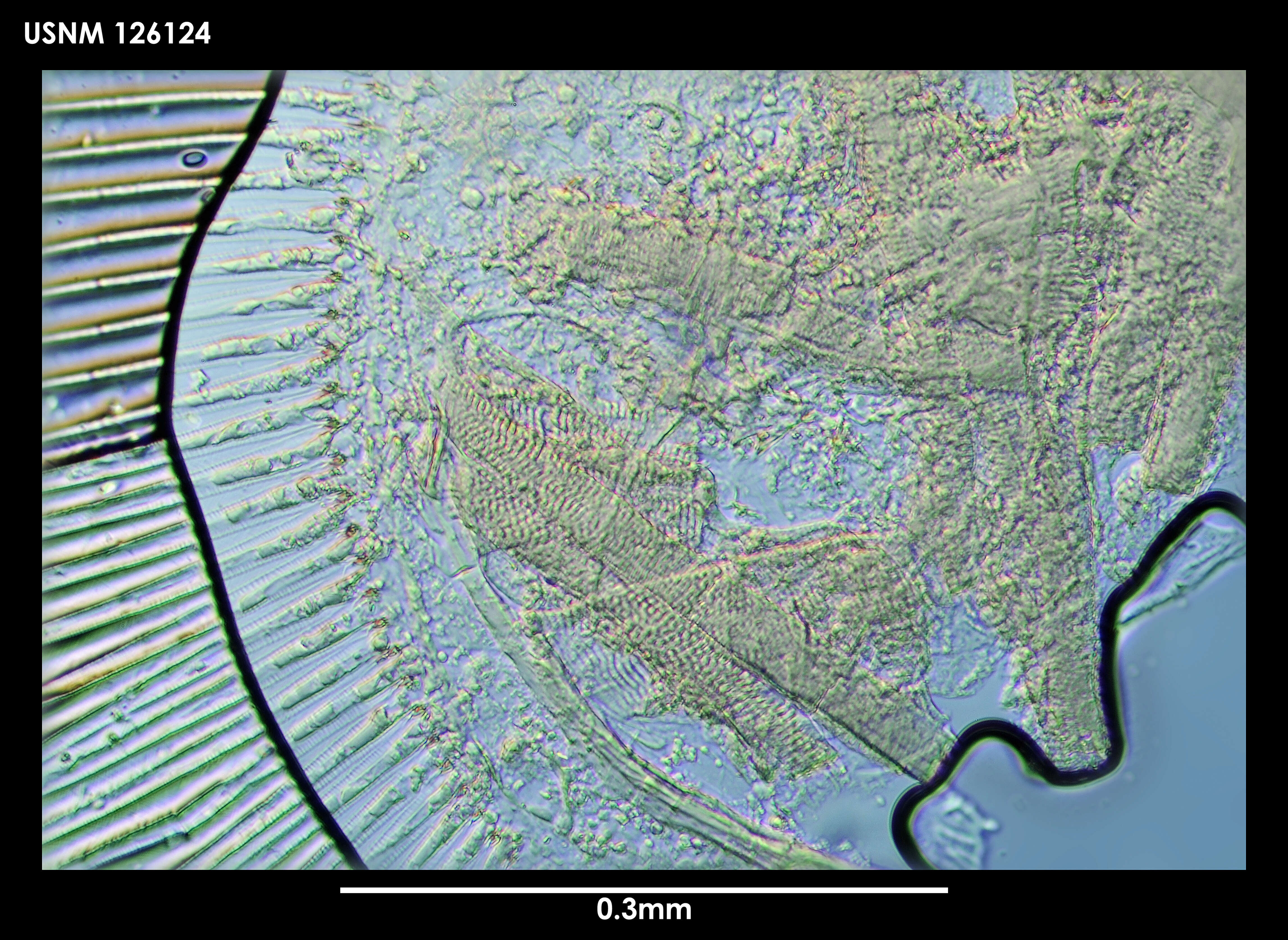 Archasterope antarctica (Kornicker 1975) resmi