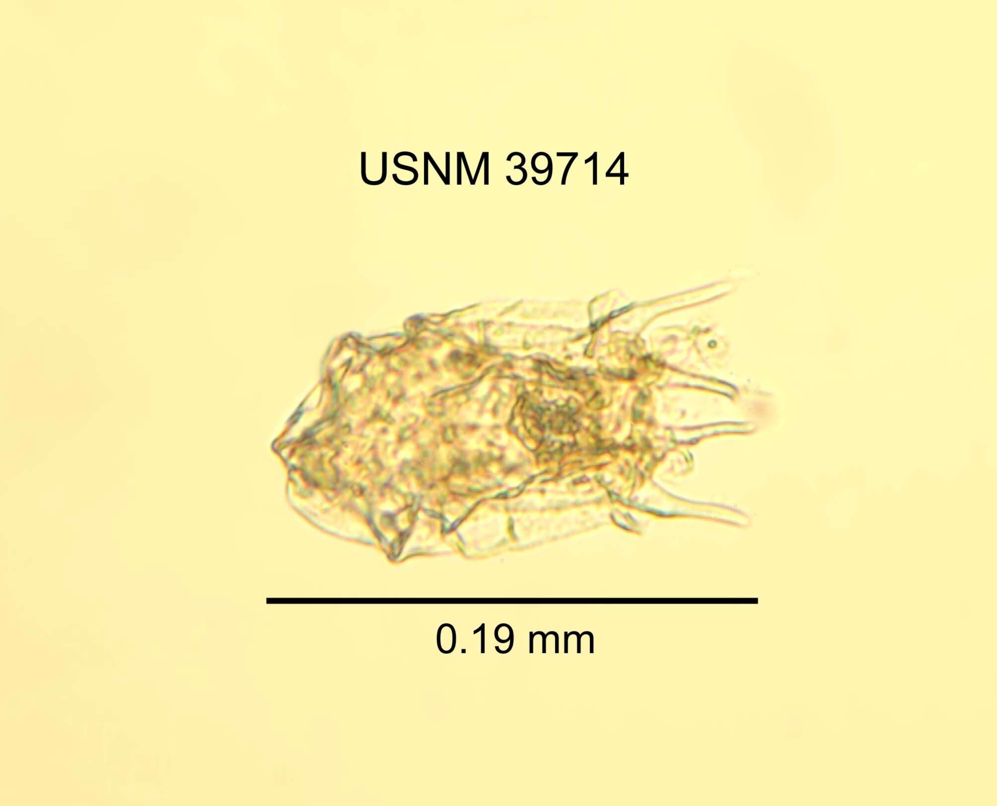 Image de Brachionus budapestinensis Daday 1885