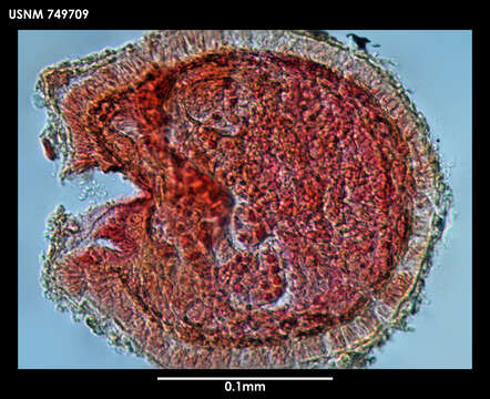 Image of Dondersia stylastericola Salvini-Plawen 1978