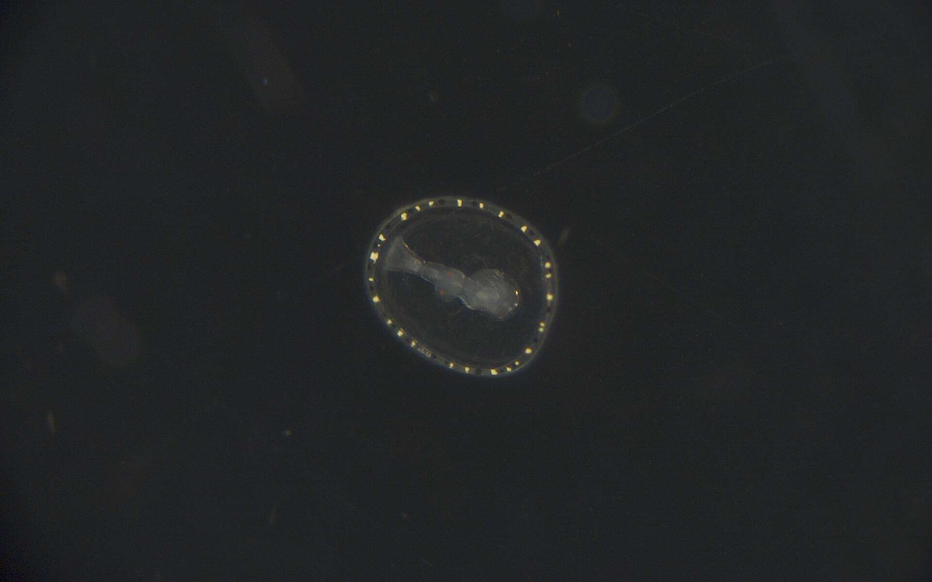 Image of segmented worms