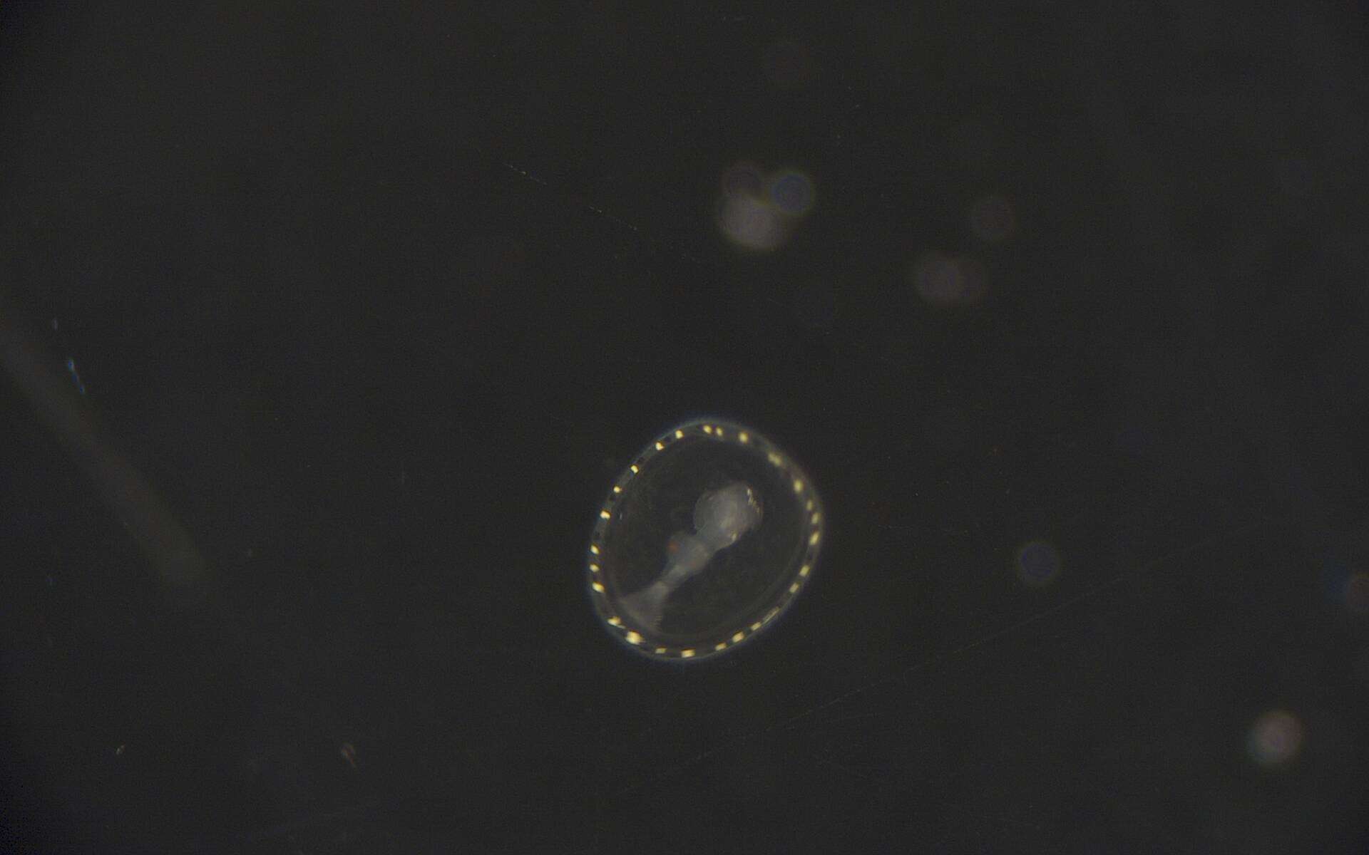 Image of segmented worms