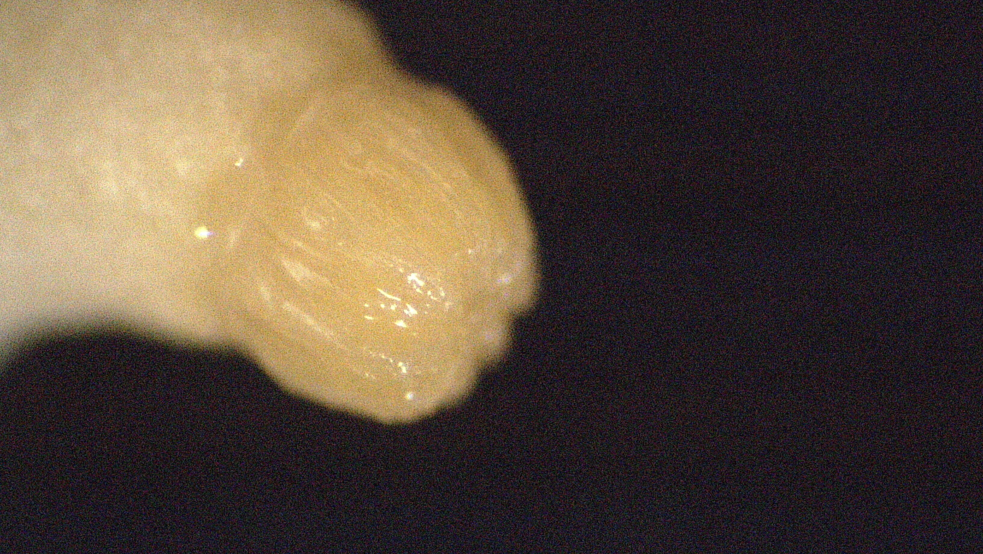 Image of Plexauridae