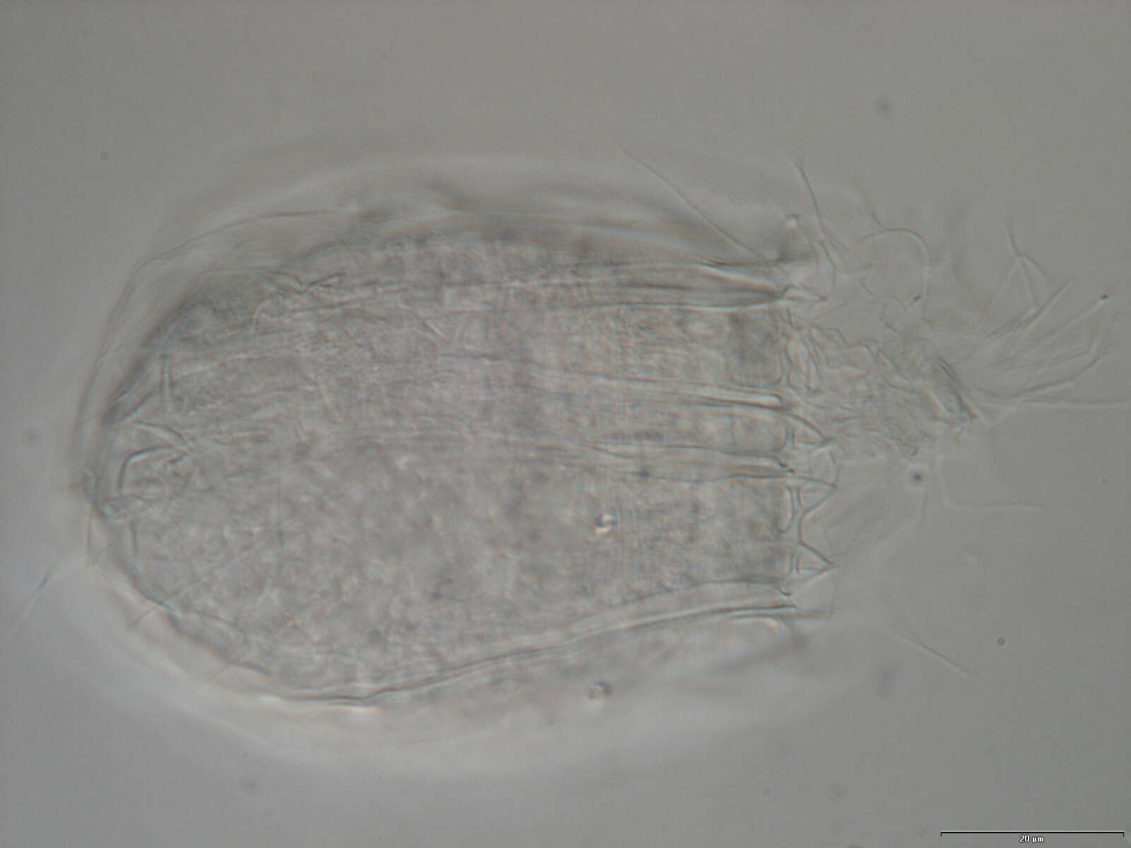 Image of Spinoloricus Heiner & Neuhaus 2007