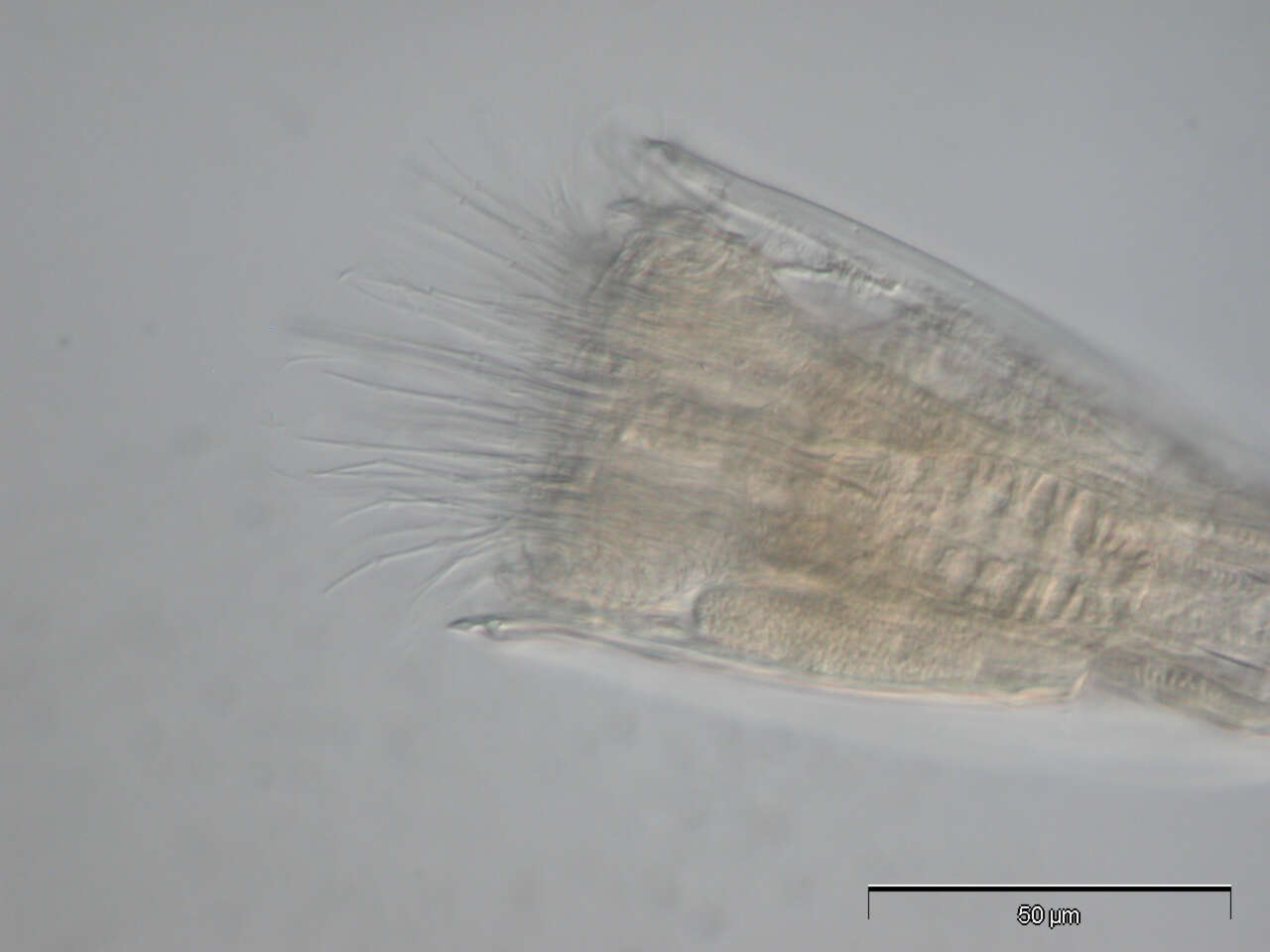 Image of Spinoloricus Heiner & Neuhaus 2007