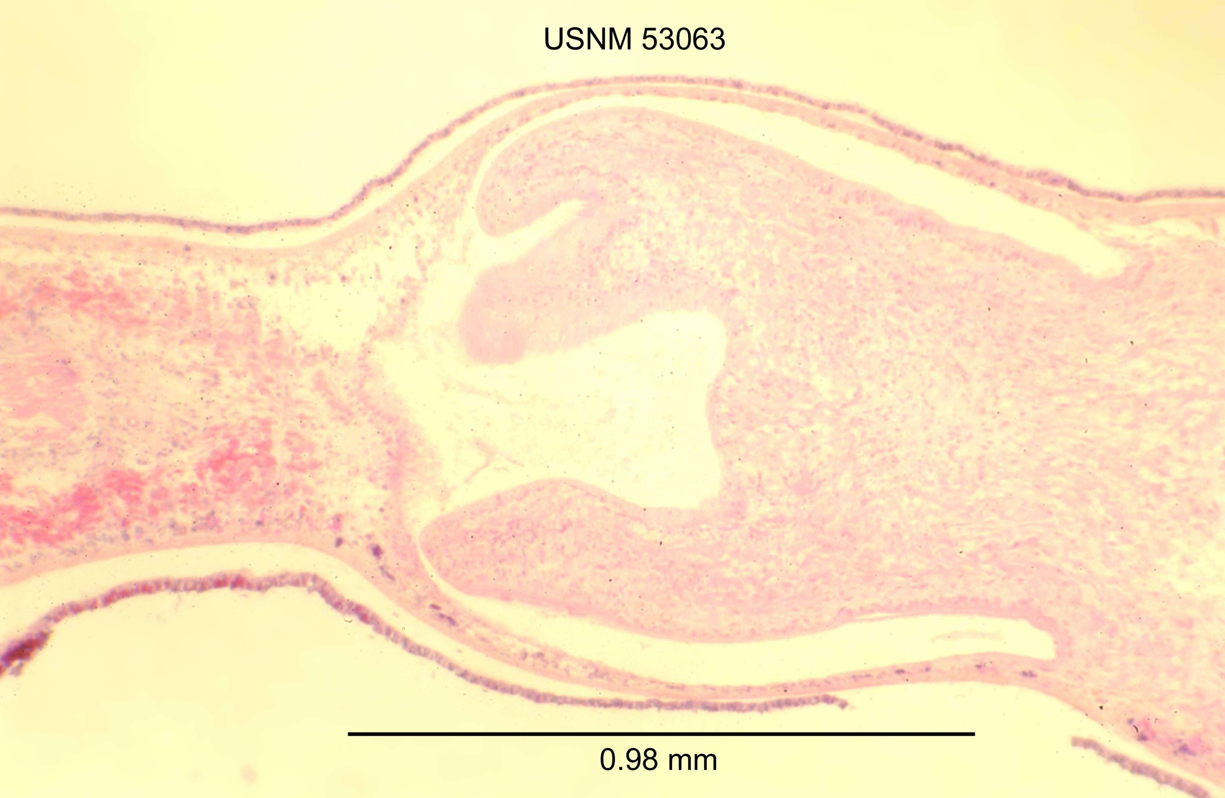 Image of unclassified Platyhelminthes