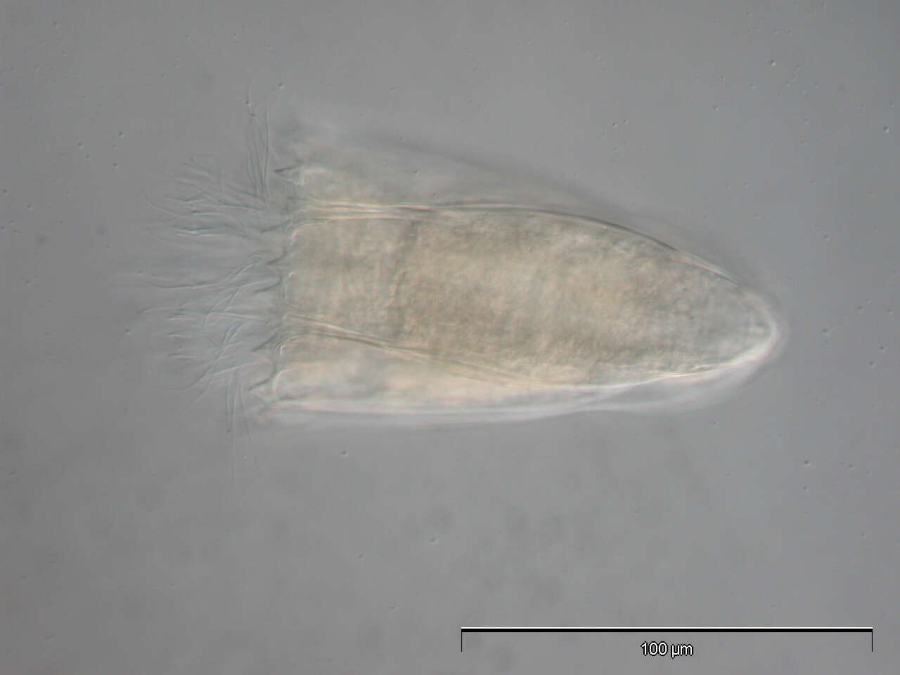 Image of Spinoloricus Heiner & Neuhaus 2007