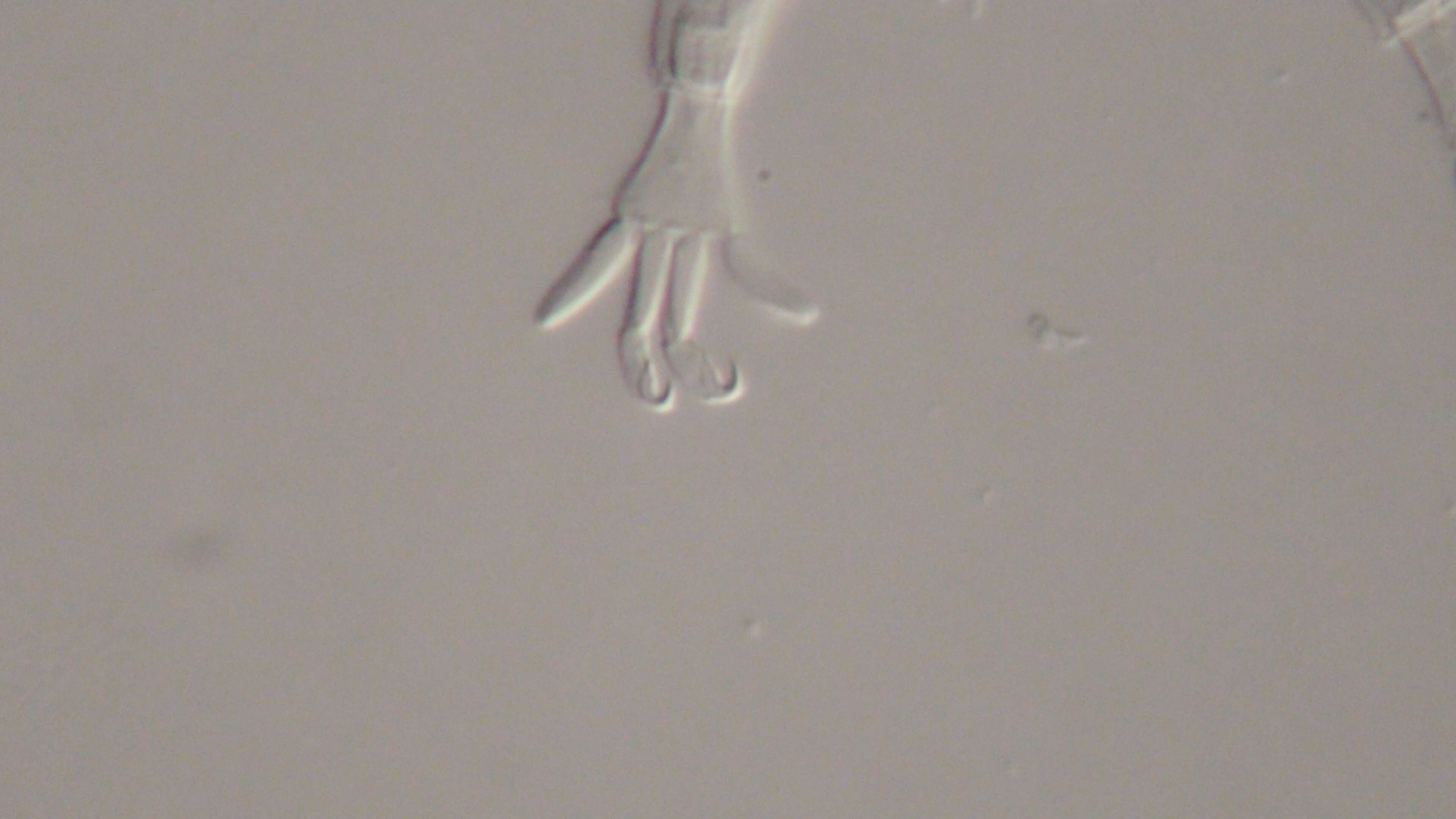 Image of Mutaparadoxipus duodigifinis Gross, Miller & Hochberg 2014