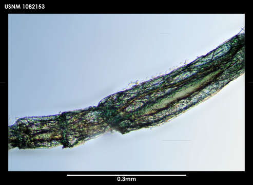 Image of Peraeospinosus Sieg 1986