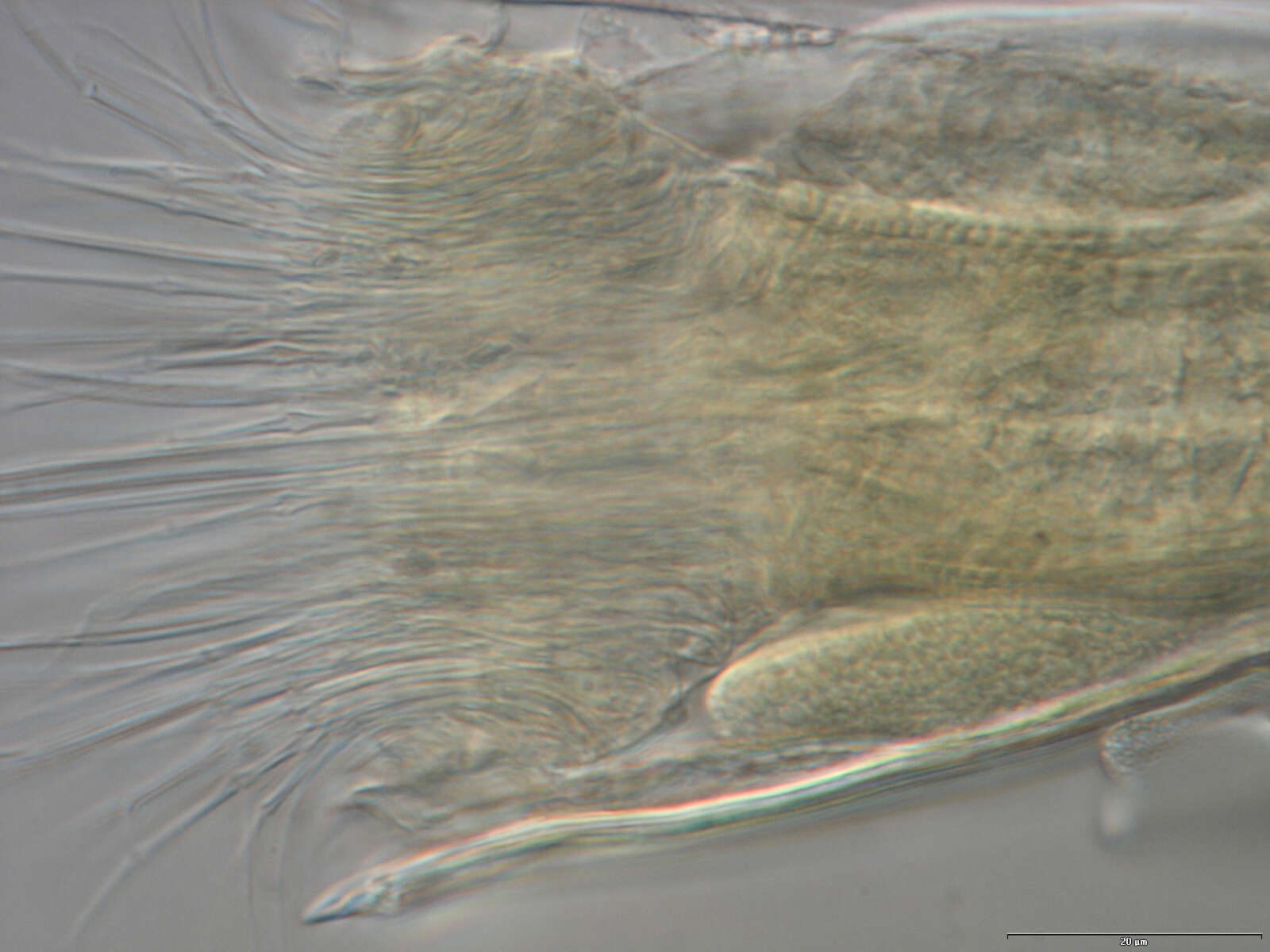 Image of Spinoloricus Heiner & Neuhaus 2007