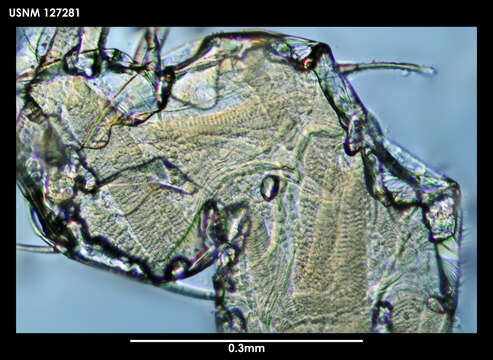 Image de Bathyleberis Kornicker 1975