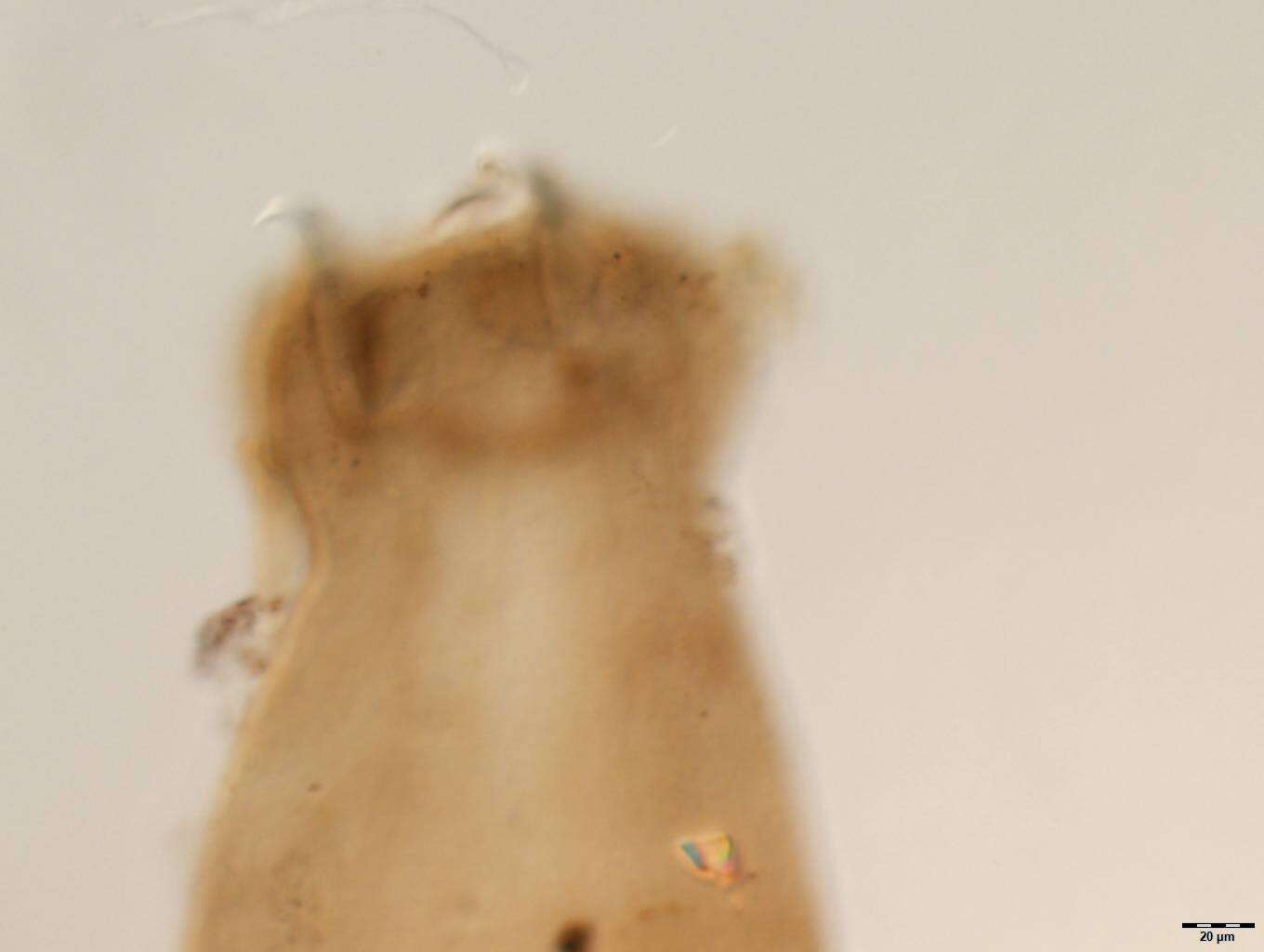 Image of Parancyrocephaloides dactylopteri Yamaguti 1968