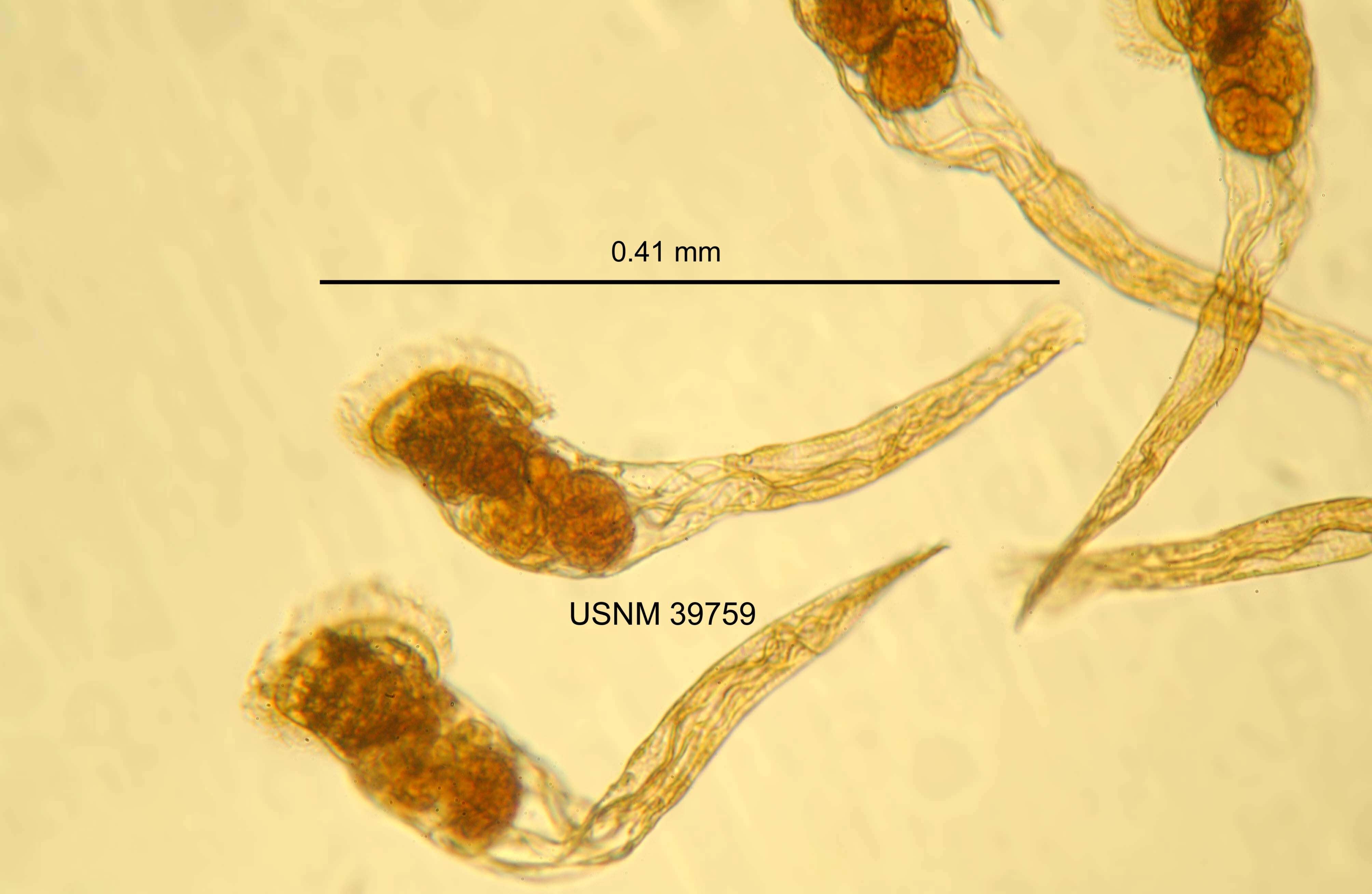 Sivun Conochilus (Conochilus) hippocrepis (Schrank 1803) kuva