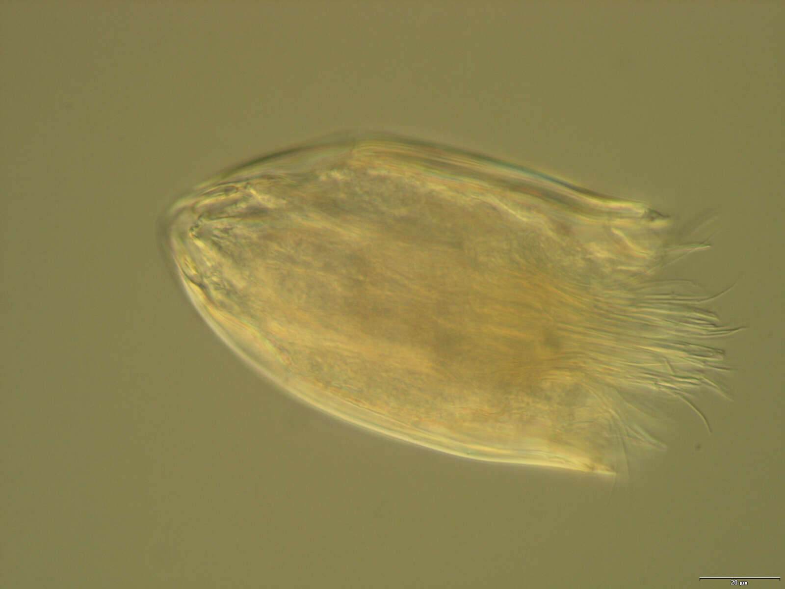 Image of Spinoloricus Heiner & Neuhaus 2007