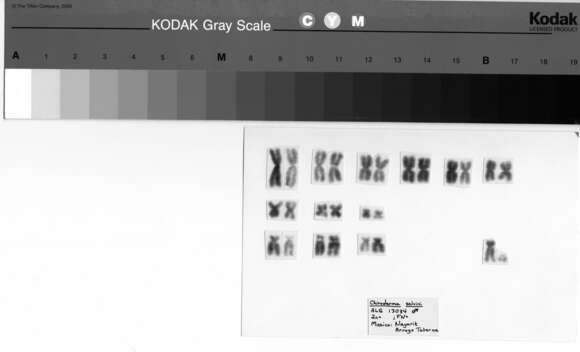 Image of Chiroderma salvini scopaeum Handley 1966