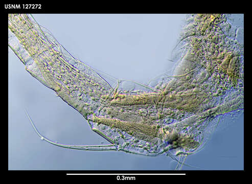 Image of Thaumatoconcha radiata Kornicker & Sohn 1976