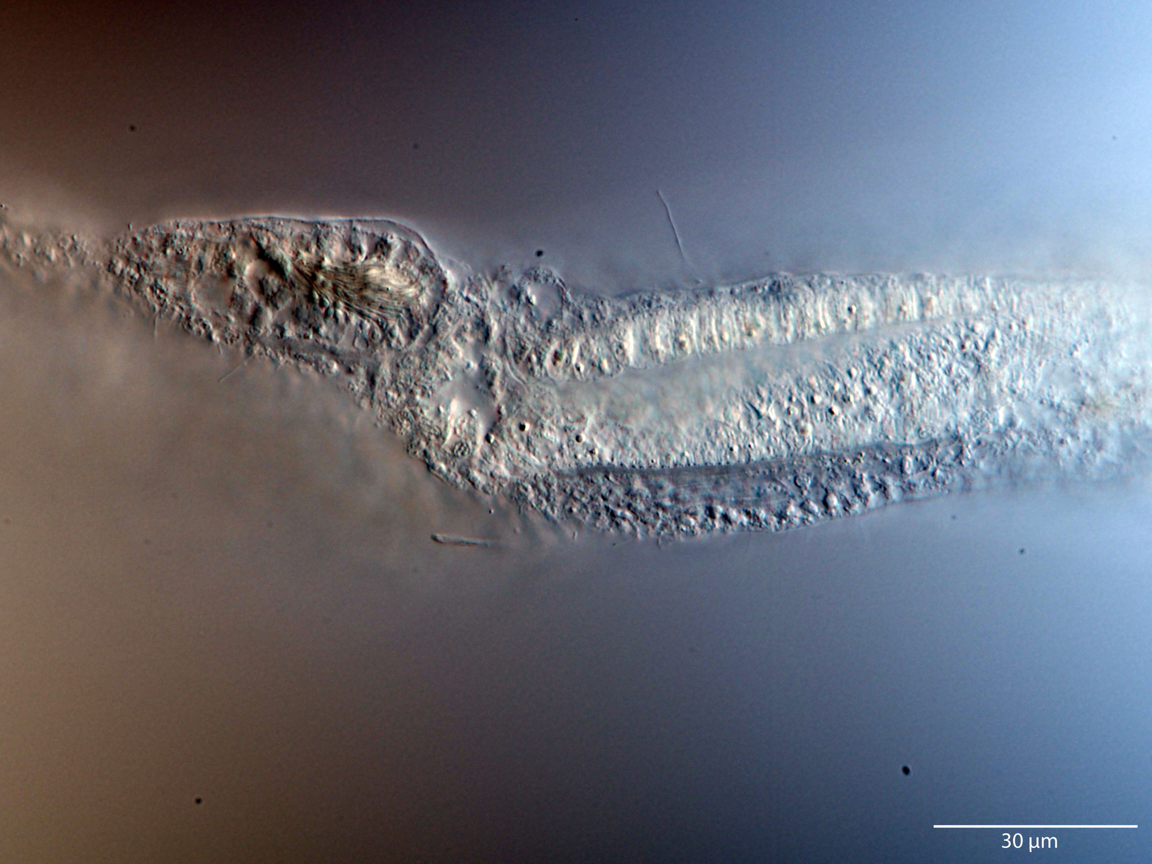 Image of Cephalodasys interinsularis Kieneke, Schmidt-Rhaesa & Hochberg 2015