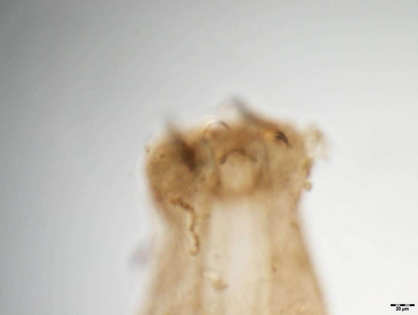 Image of Parancyrocephaloides dactylopteri Yamaguti 1968