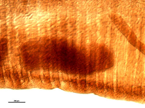 Image of Mediorhynchus robustus Van Cleave 1916