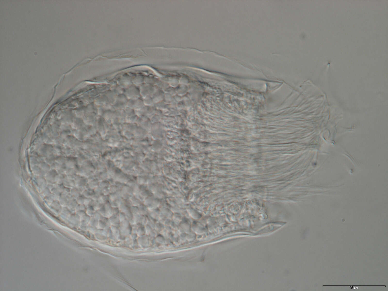 Image of Spinoloricus Heiner & Neuhaus 2007