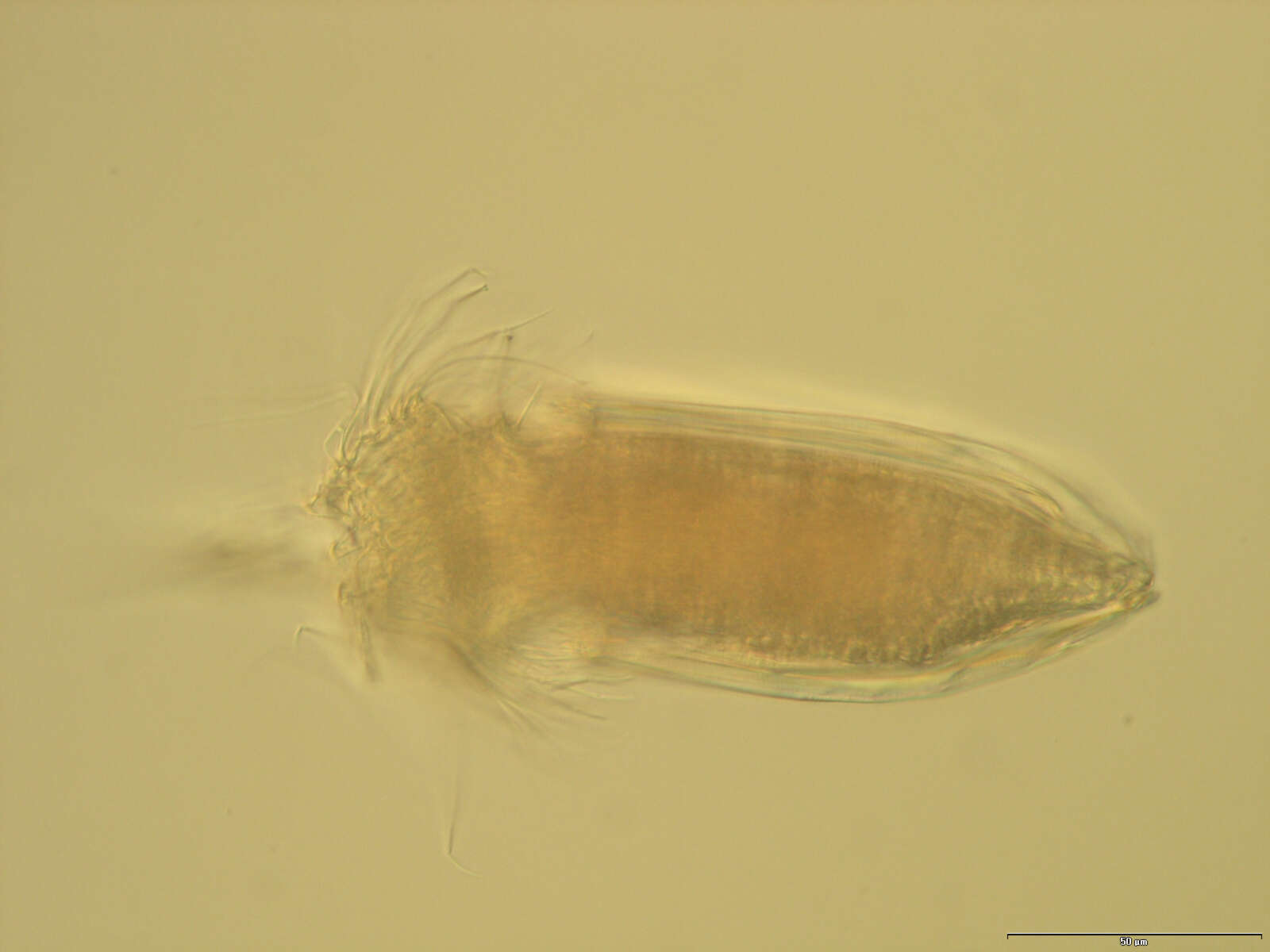 Image of Spinoloricus Heiner & Neuhaus 2007