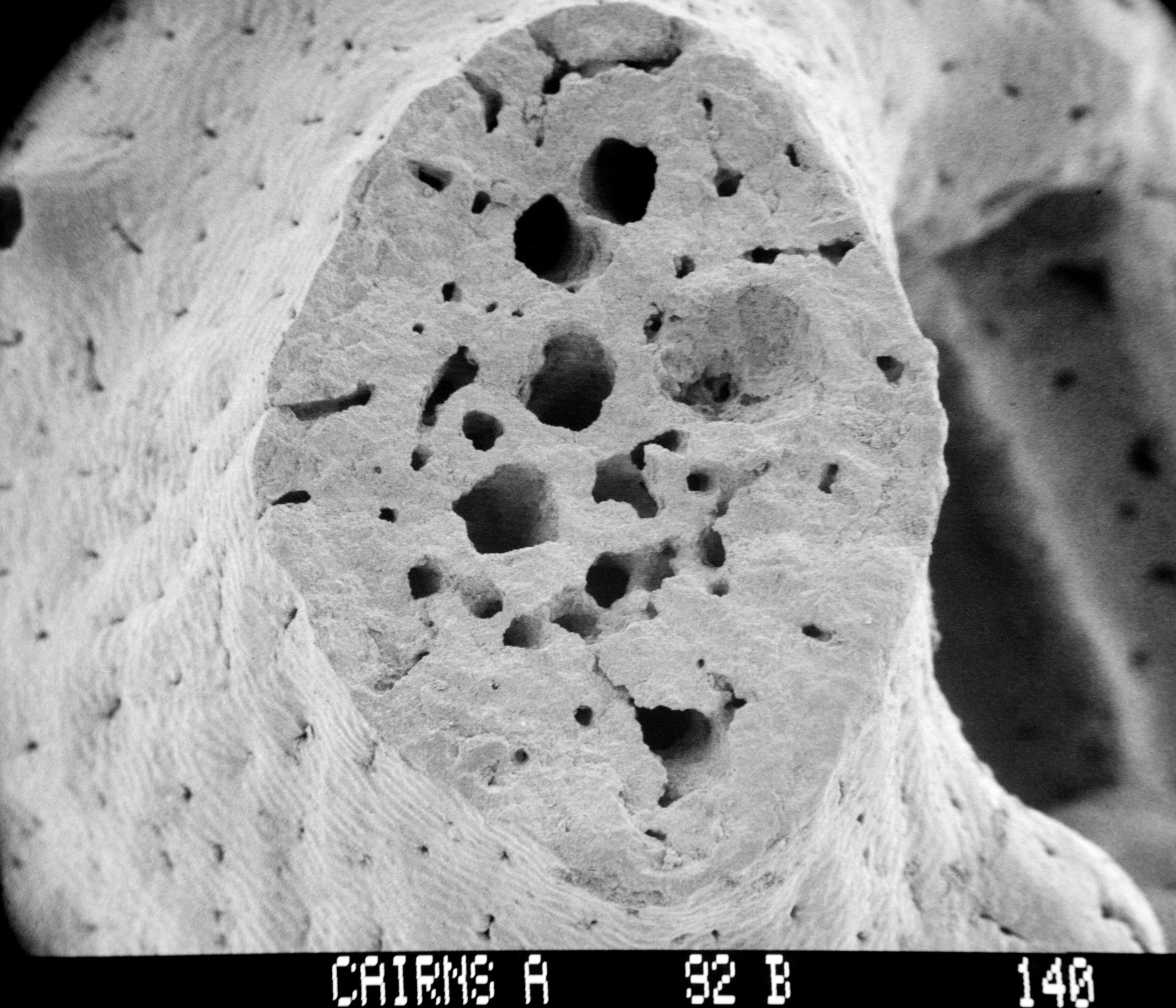 Image of Adelopora pseudothyron Cairns 1982