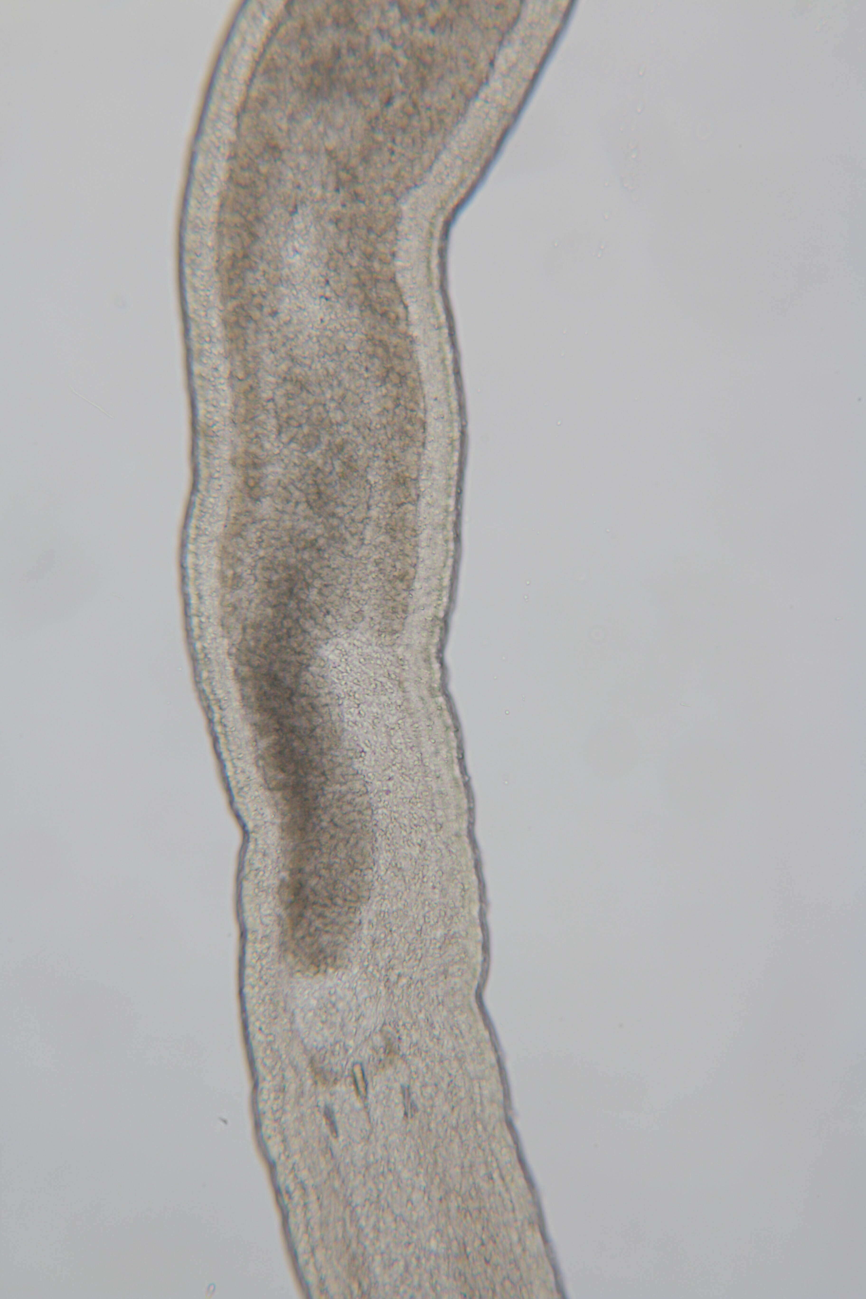 Image of Ototyphlonemertes (Duplex) duplex Bürger 1895