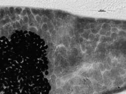 Image of Polylekithum ictaluri (Pearse 1924) Arnold 1934