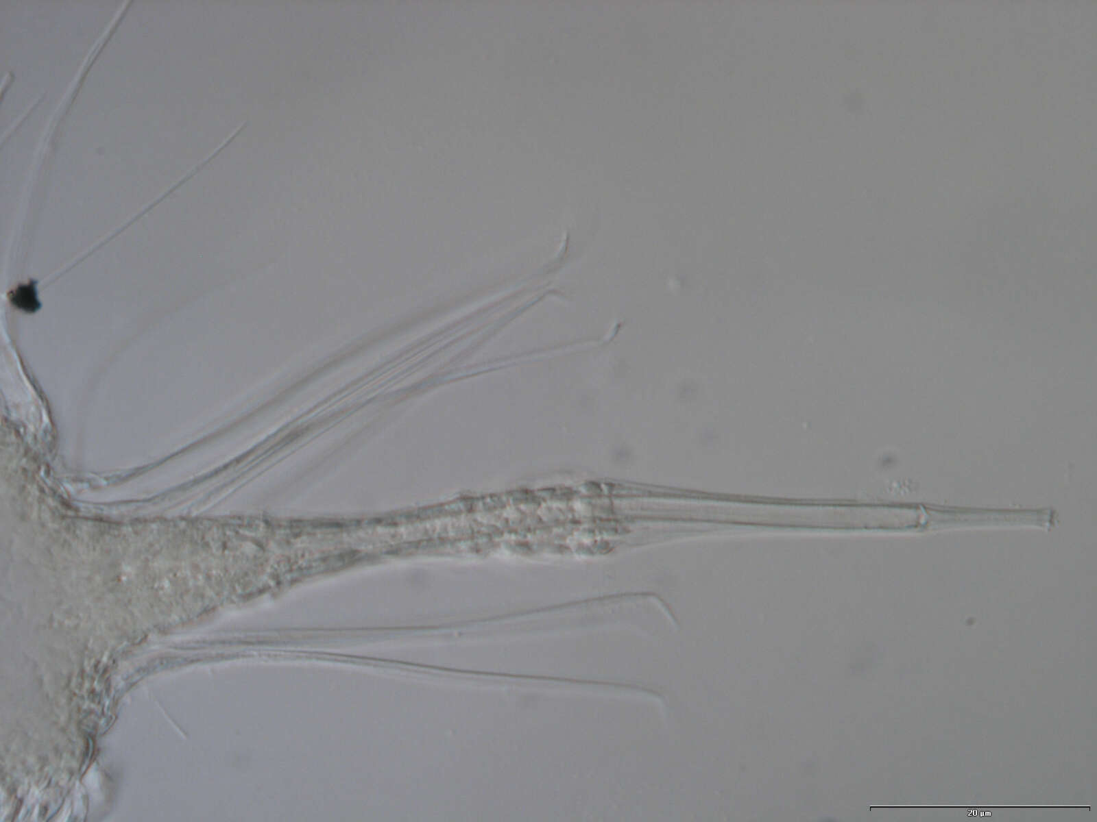 Image of Nanaloricidae