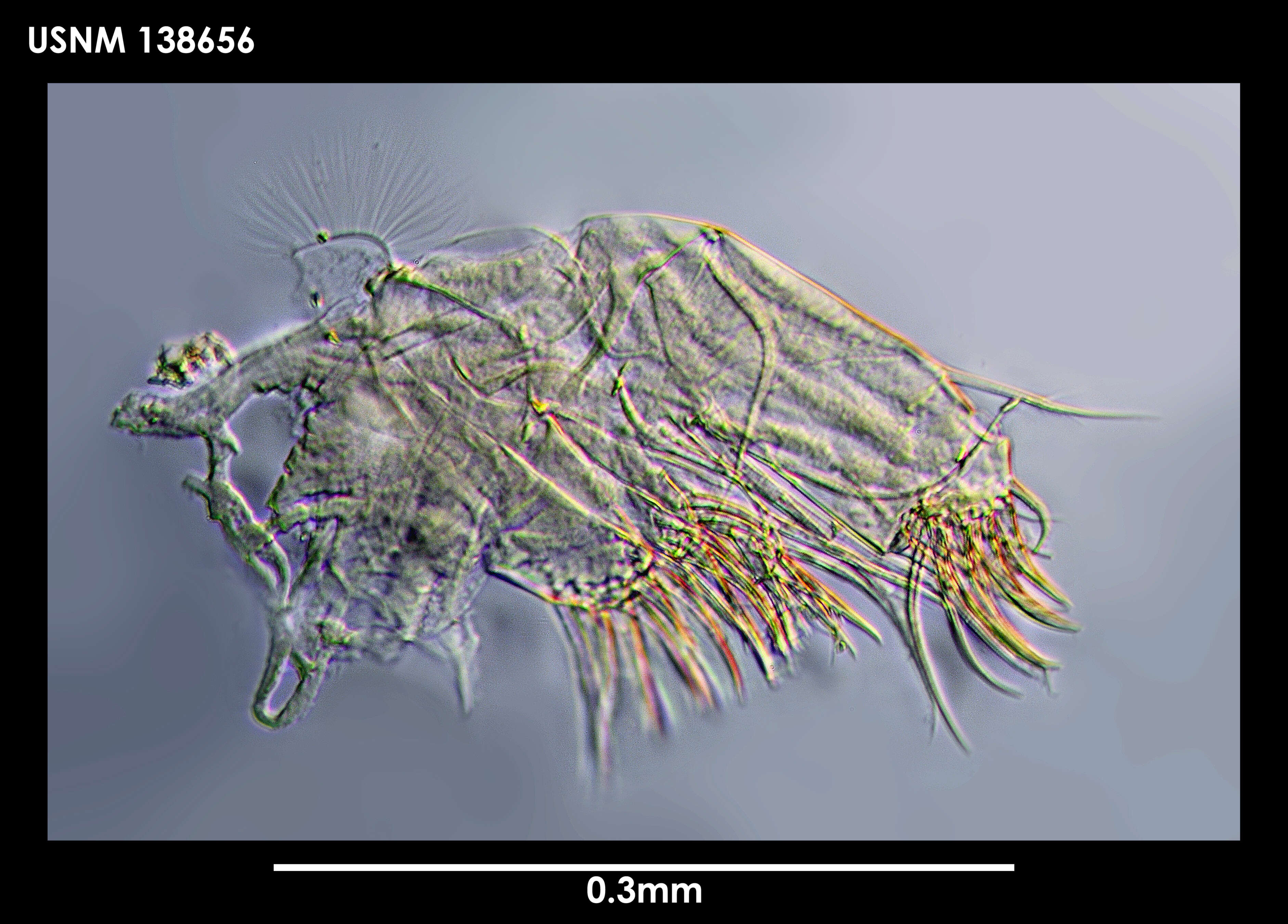 Image de Philomedes cubitum Kornicker 1975