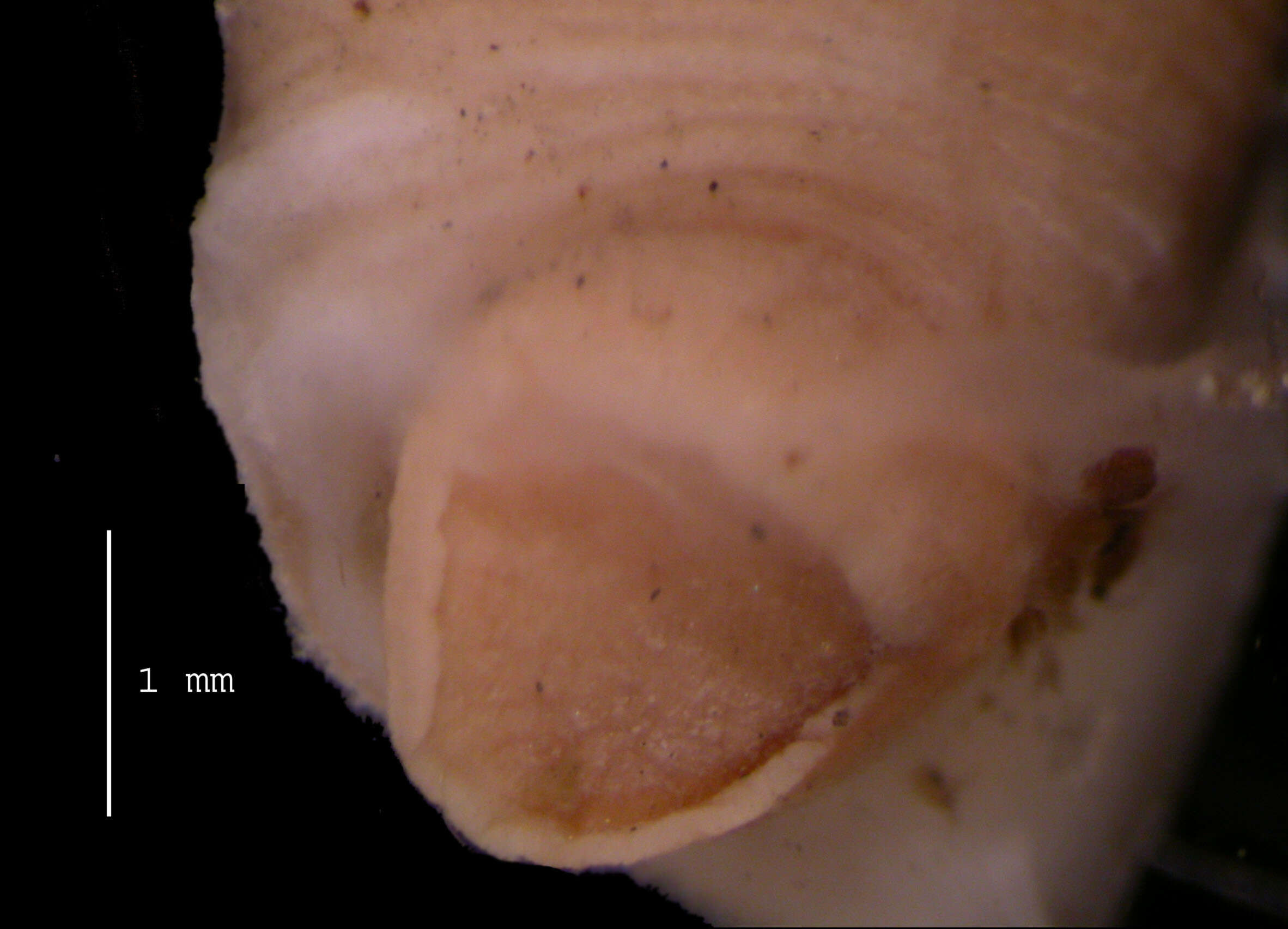 Image of Trachelobdellina glabra Moore 1957