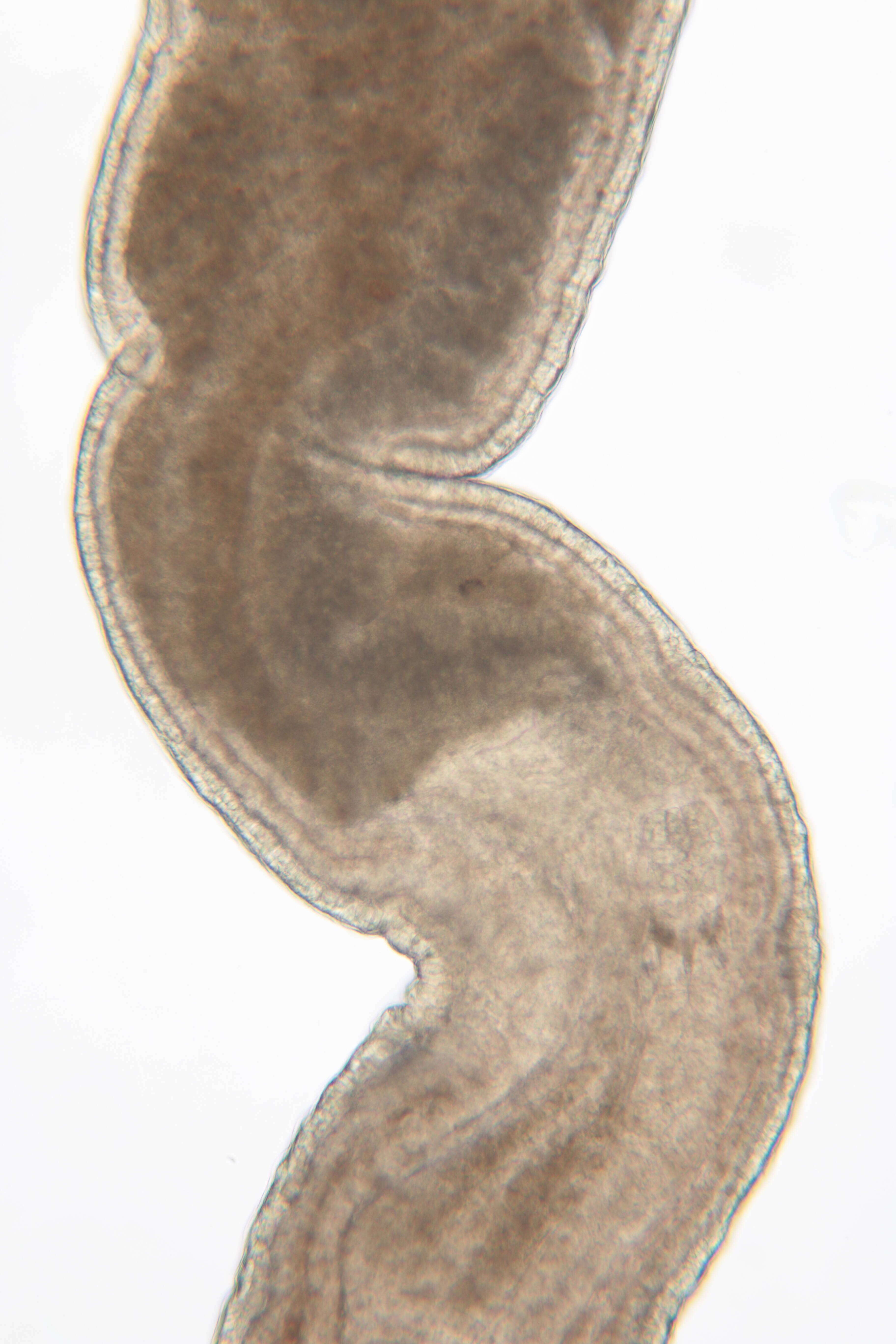 Image of Ototyphlonemertes (Duplex) duplex Bürger 1895