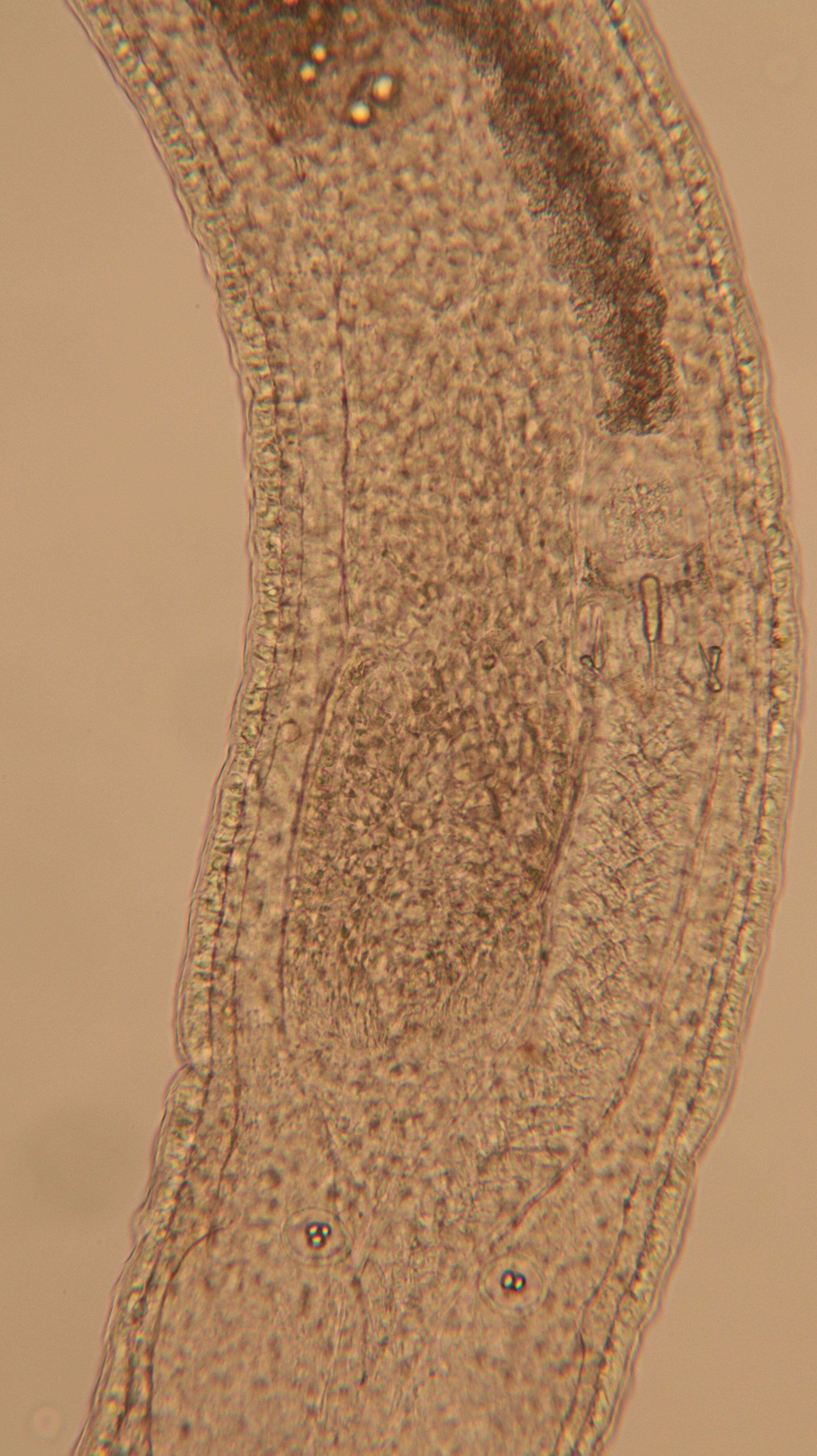 Image of Ototyphlonemertes (Duplex) duplex Bürger 1895