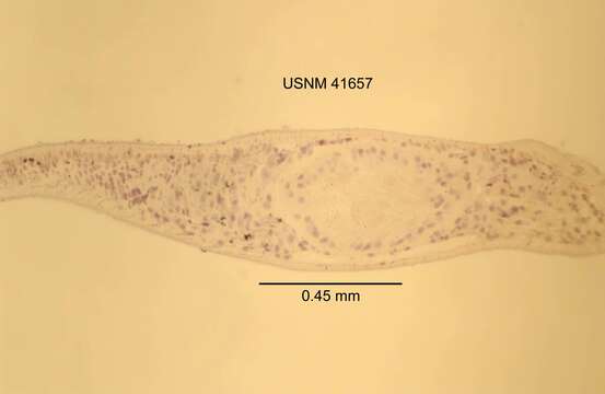 Image de Geocentrophora cavernicola Carpenter 1970