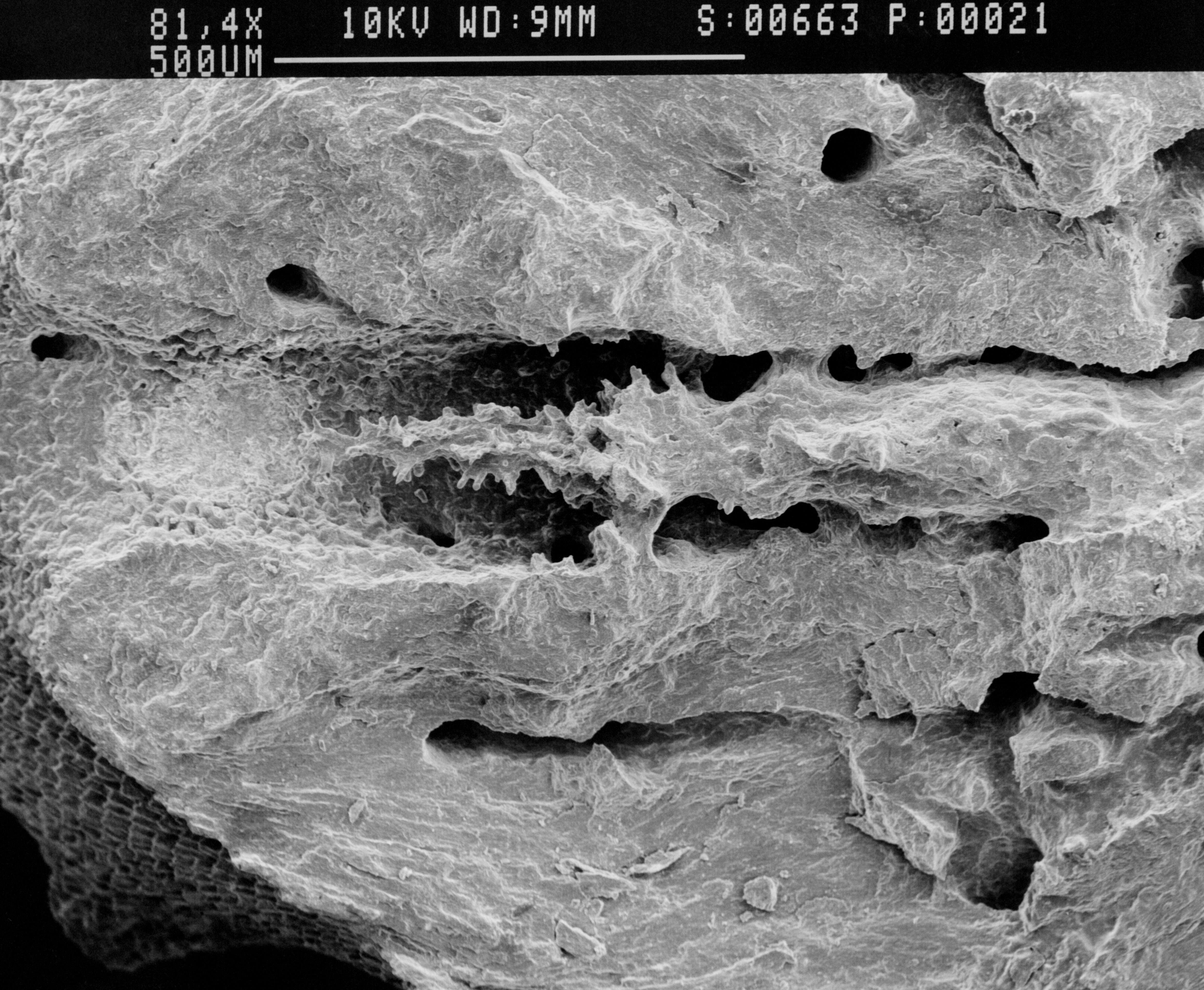 Image of Lepidotheca fascicularis (Cairns 1983)