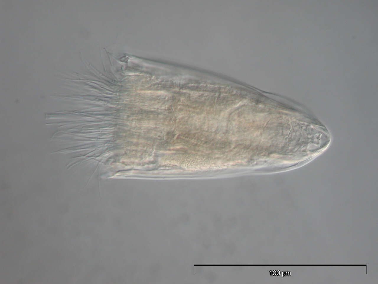 Image of Spinoloricus Heiner & Neuhaus 2007