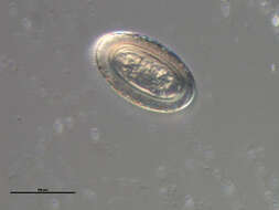 Image of Prosthenorchis elegans (Diesing 1851)