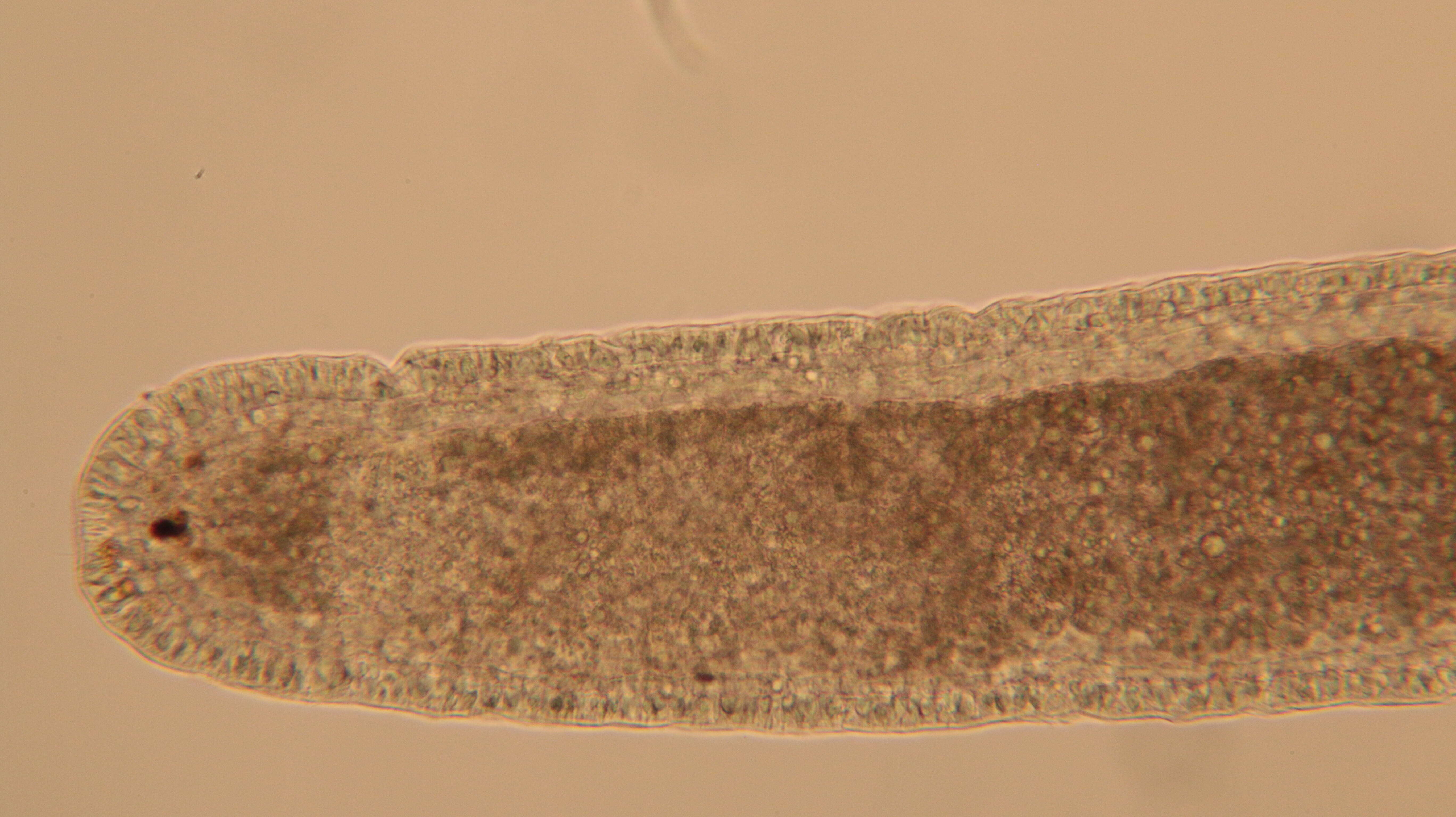 Image of Ototyphlonemertes (Duplex) duplex Bürger 1895