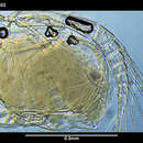 Image of Parasterope micrommata Kornicker 1975
