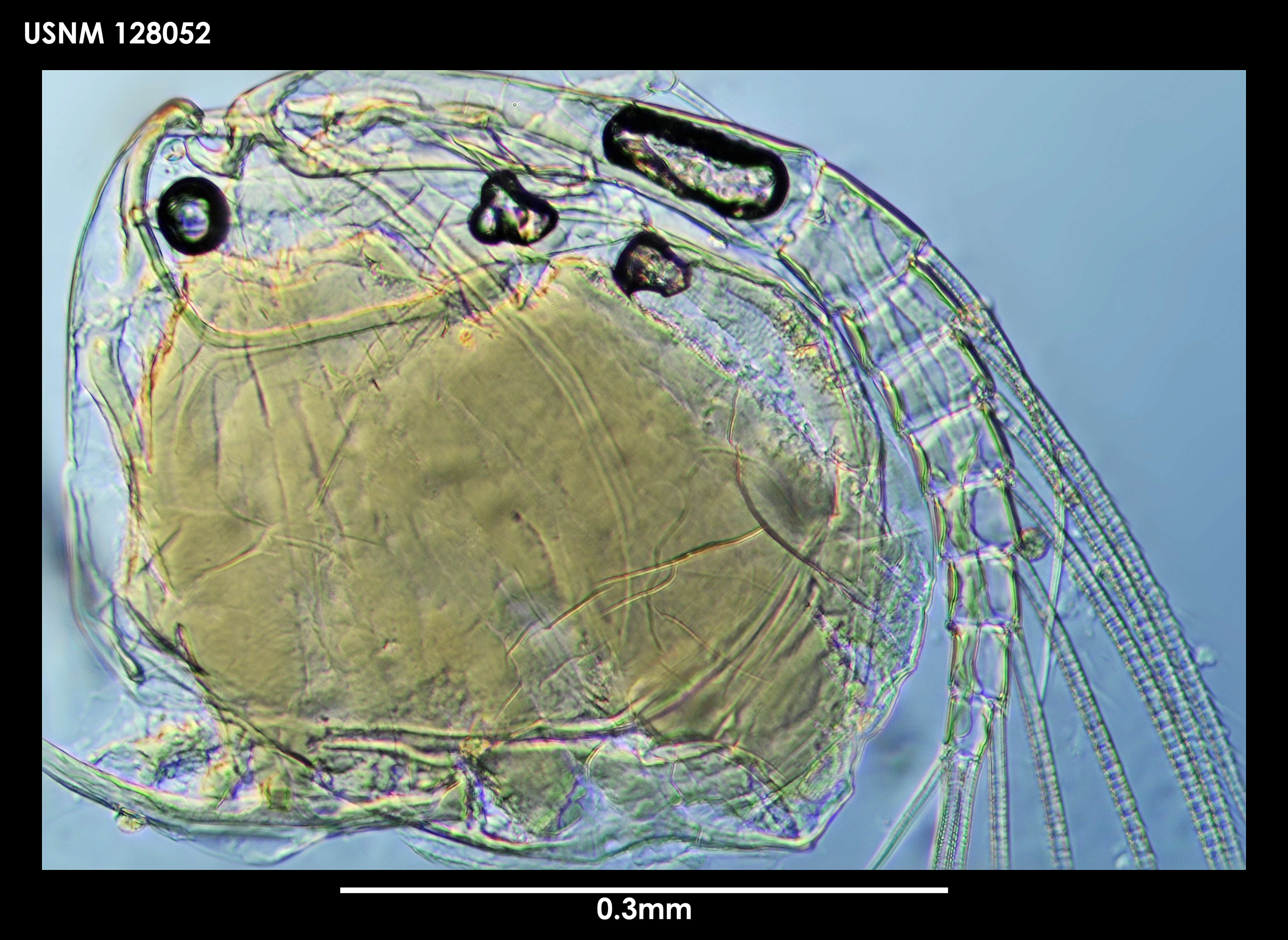 Image de Parasterope micrommata Kornicker 1975