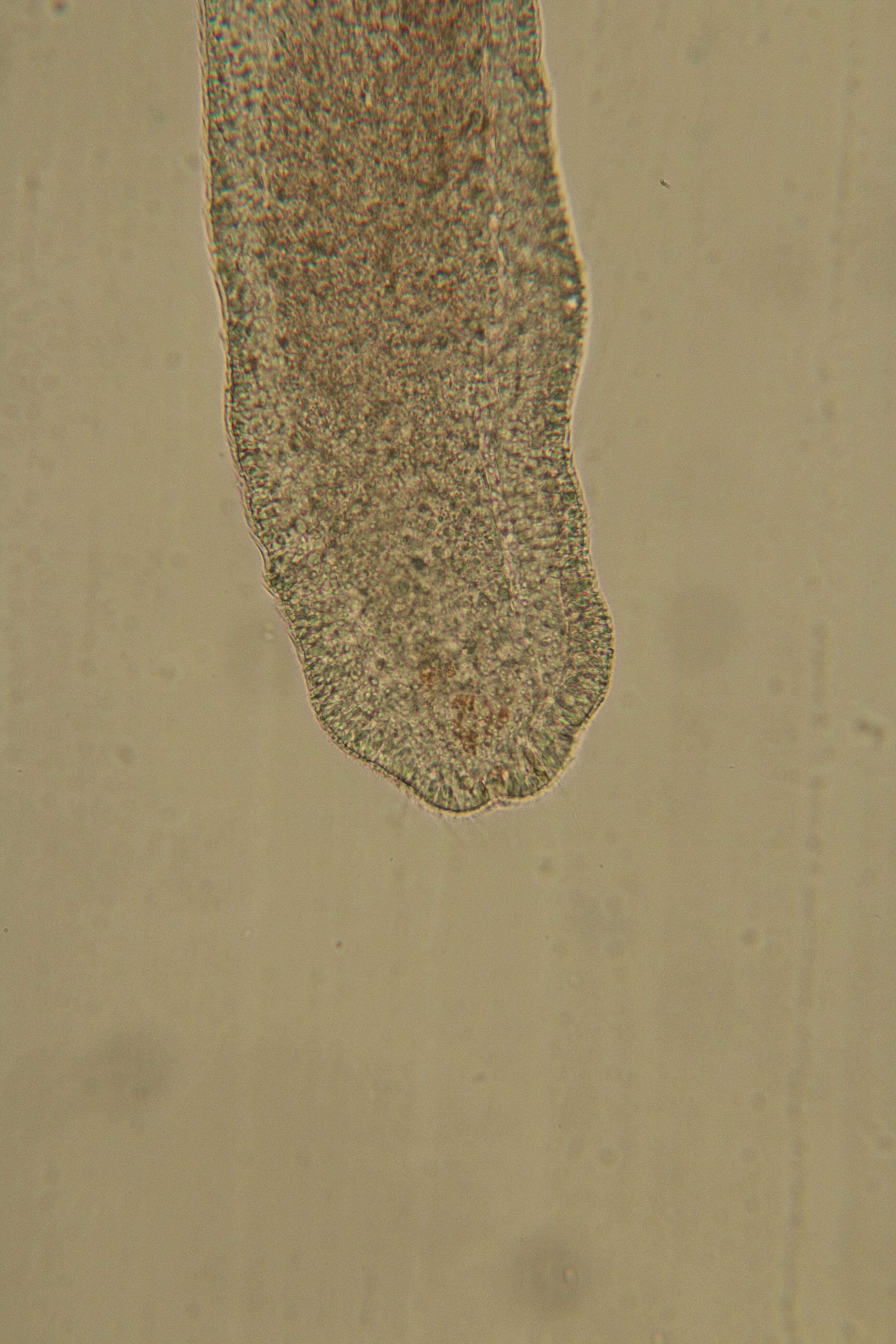 Image of Ototyphlonemertes (Duplex) duplex Bürger 1895