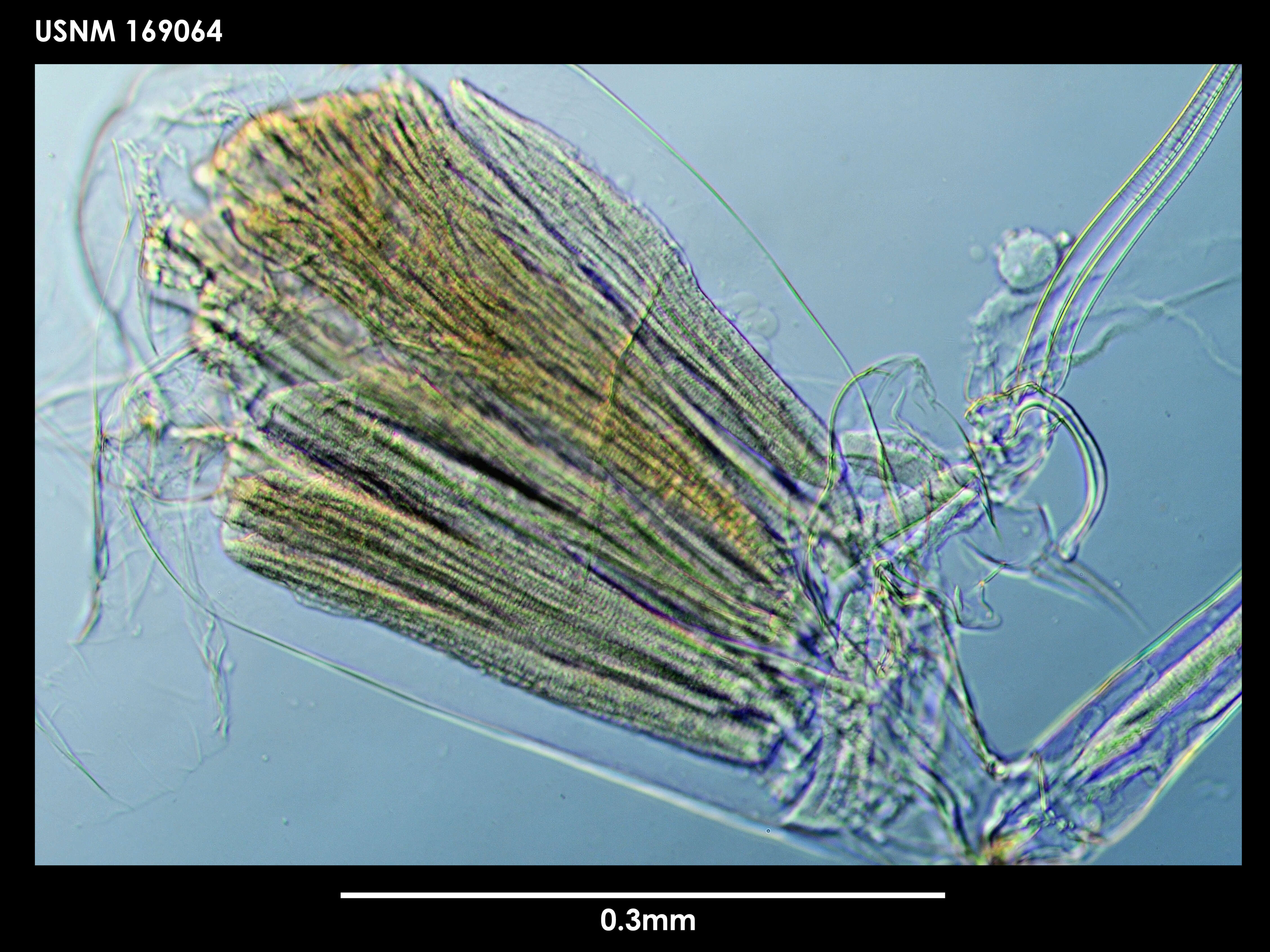 Image of Conchoecia arcuata Deevey